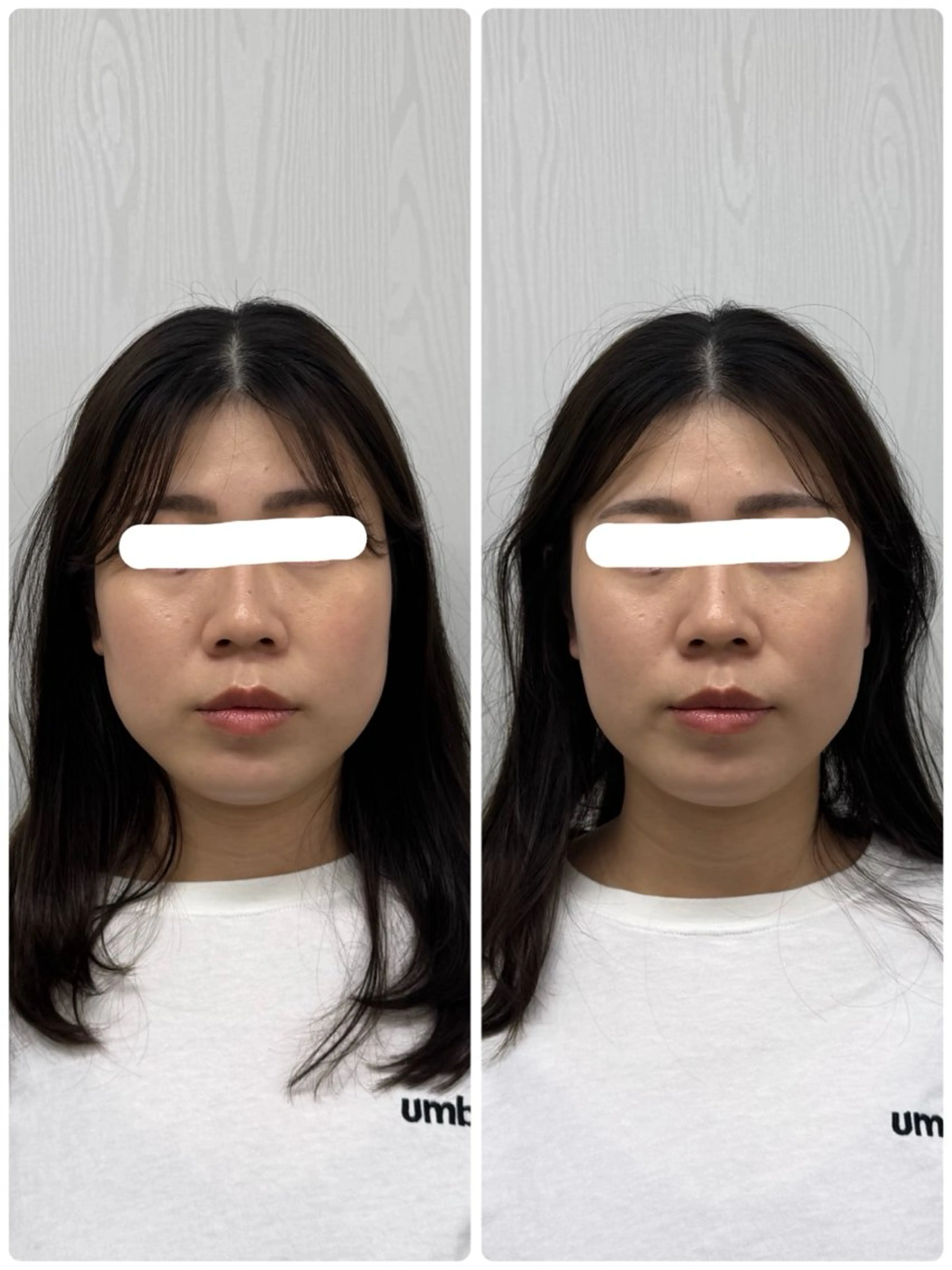 美容鍼×小顔矯正 ×美容整体　浜川泰仁のエステ・リラクイメージ