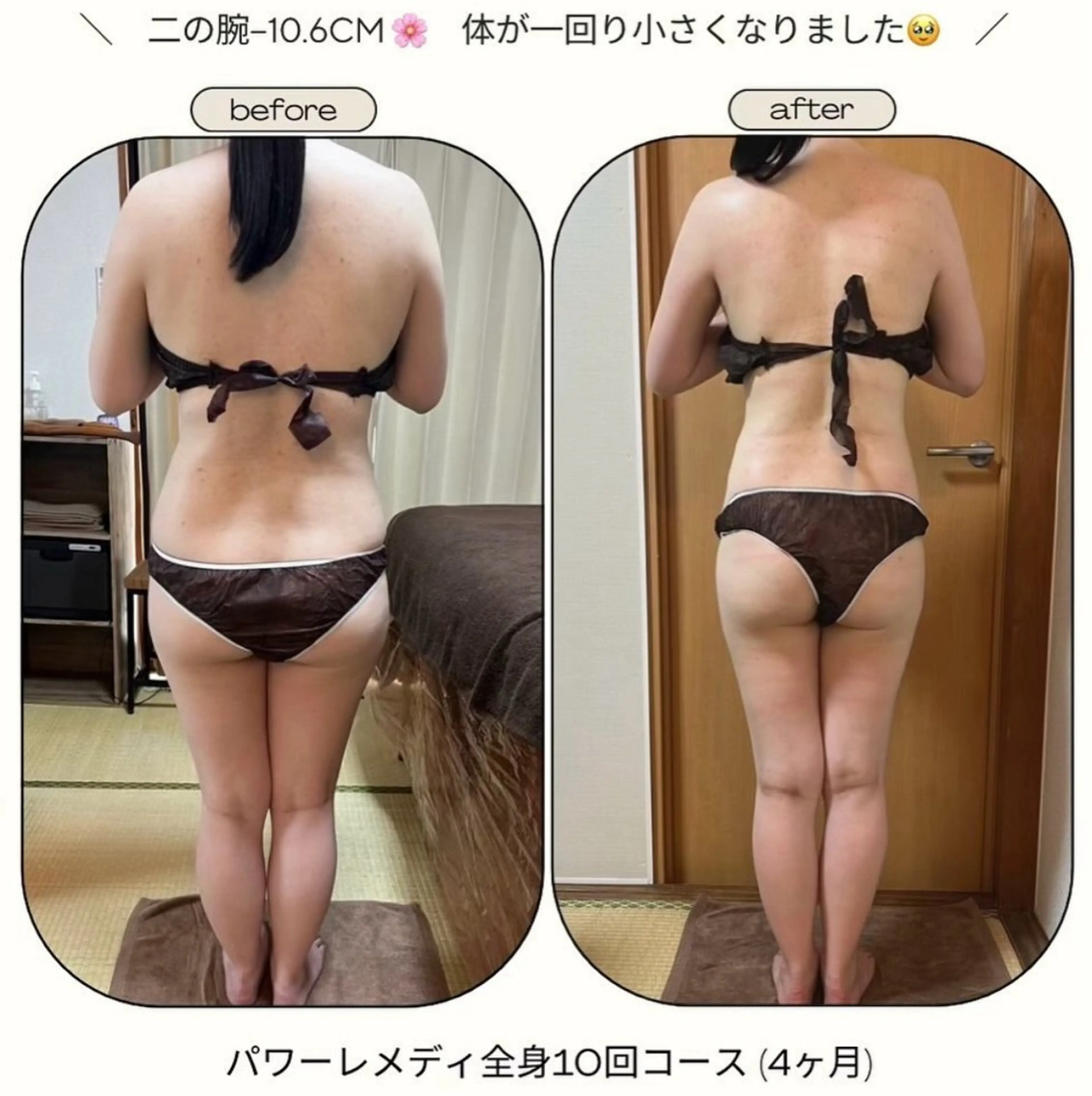 《本気痩せ×疲労改善 》  BILOOPのエステ・リラクイメージ