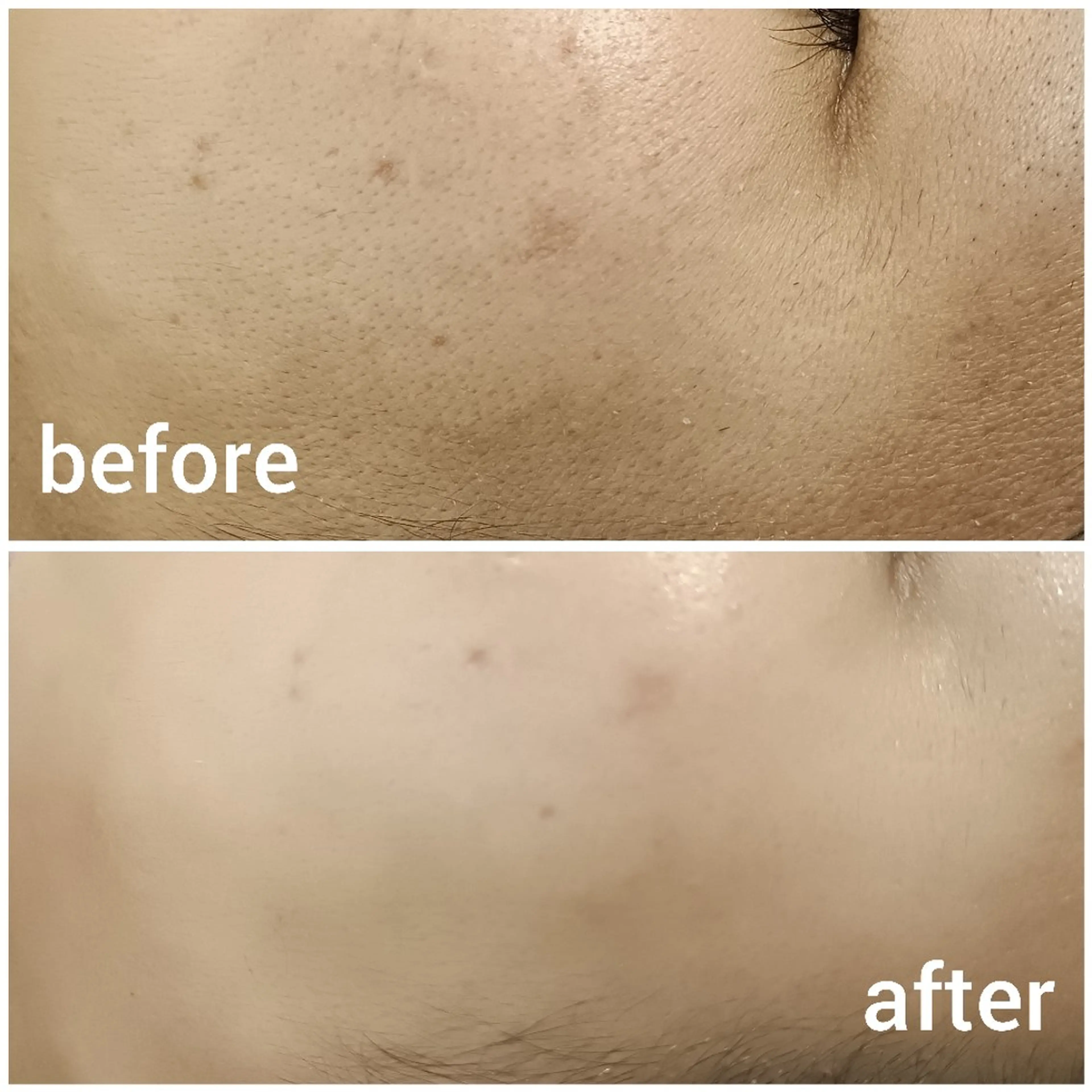 ゼロス｜癒し×小顔 エステ＆耳ツボサロンのエステ・リラクイメージ