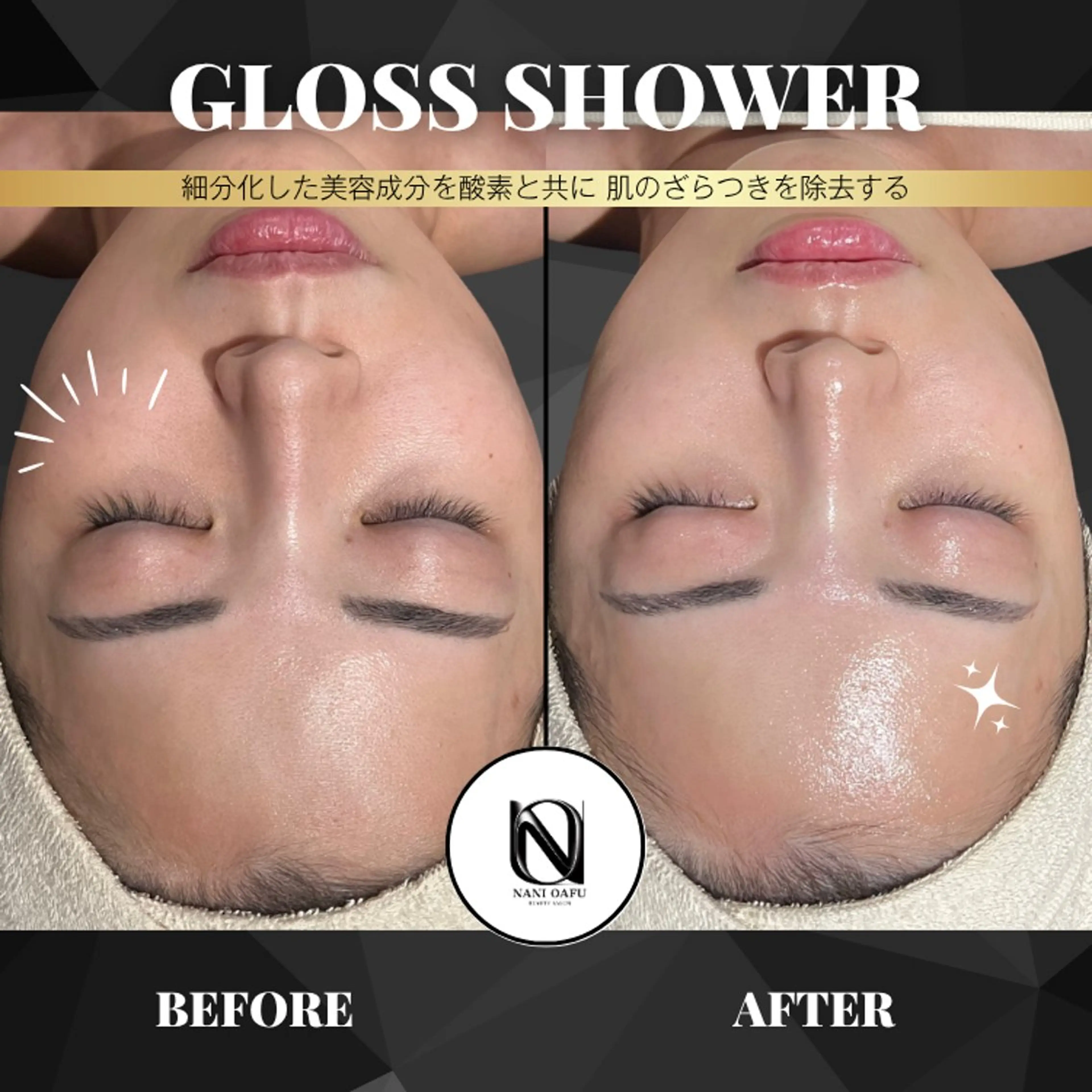 【🫧韓国式艶肌×透明感ケア】GLOSS SHOWER｜敏感肌・ダウンタイム肌にもおすすめ〈本町限定〉の写真