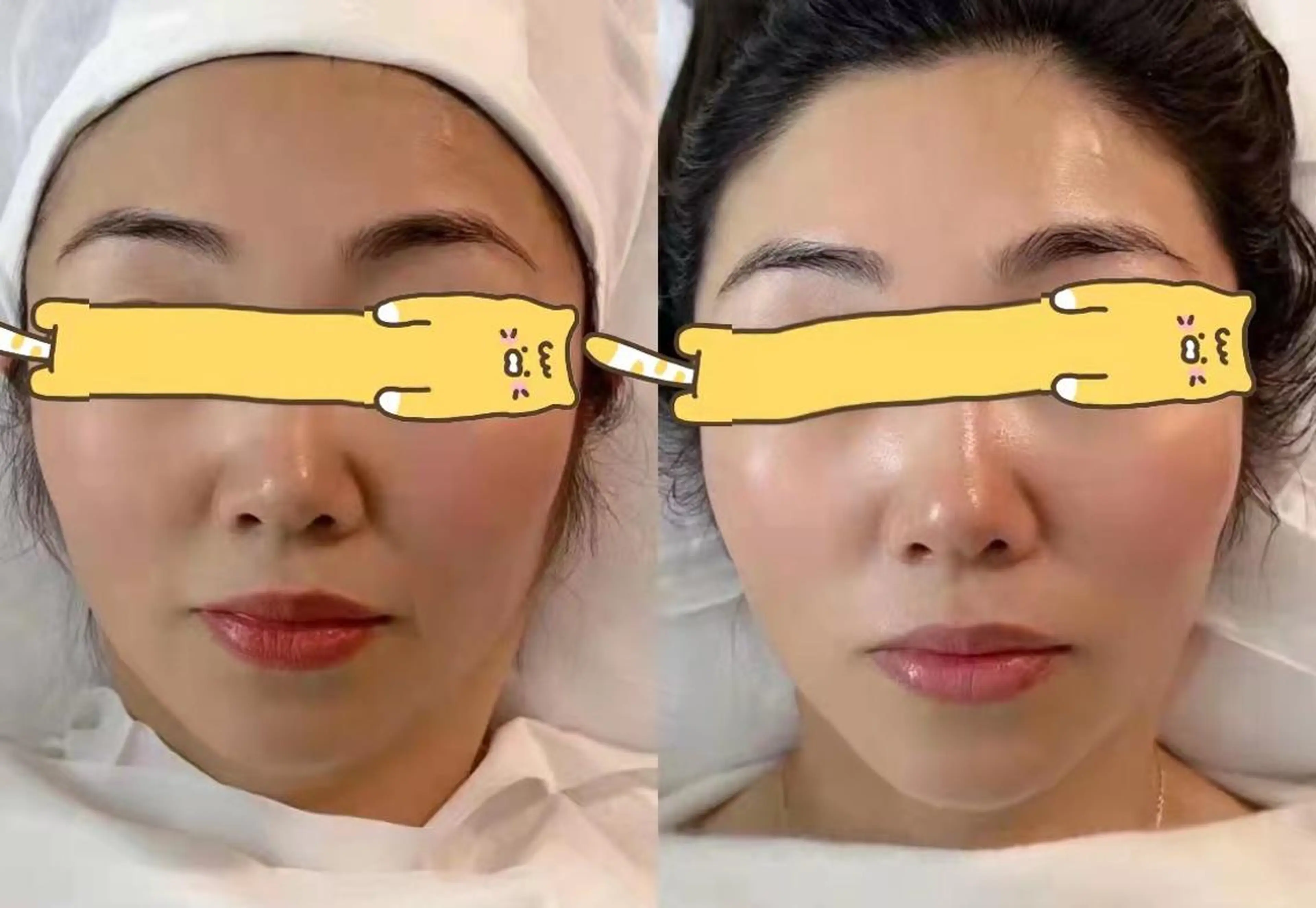 エステ aliaハーブ水光店 エステティシャン募集のエステ・リラクイメージ