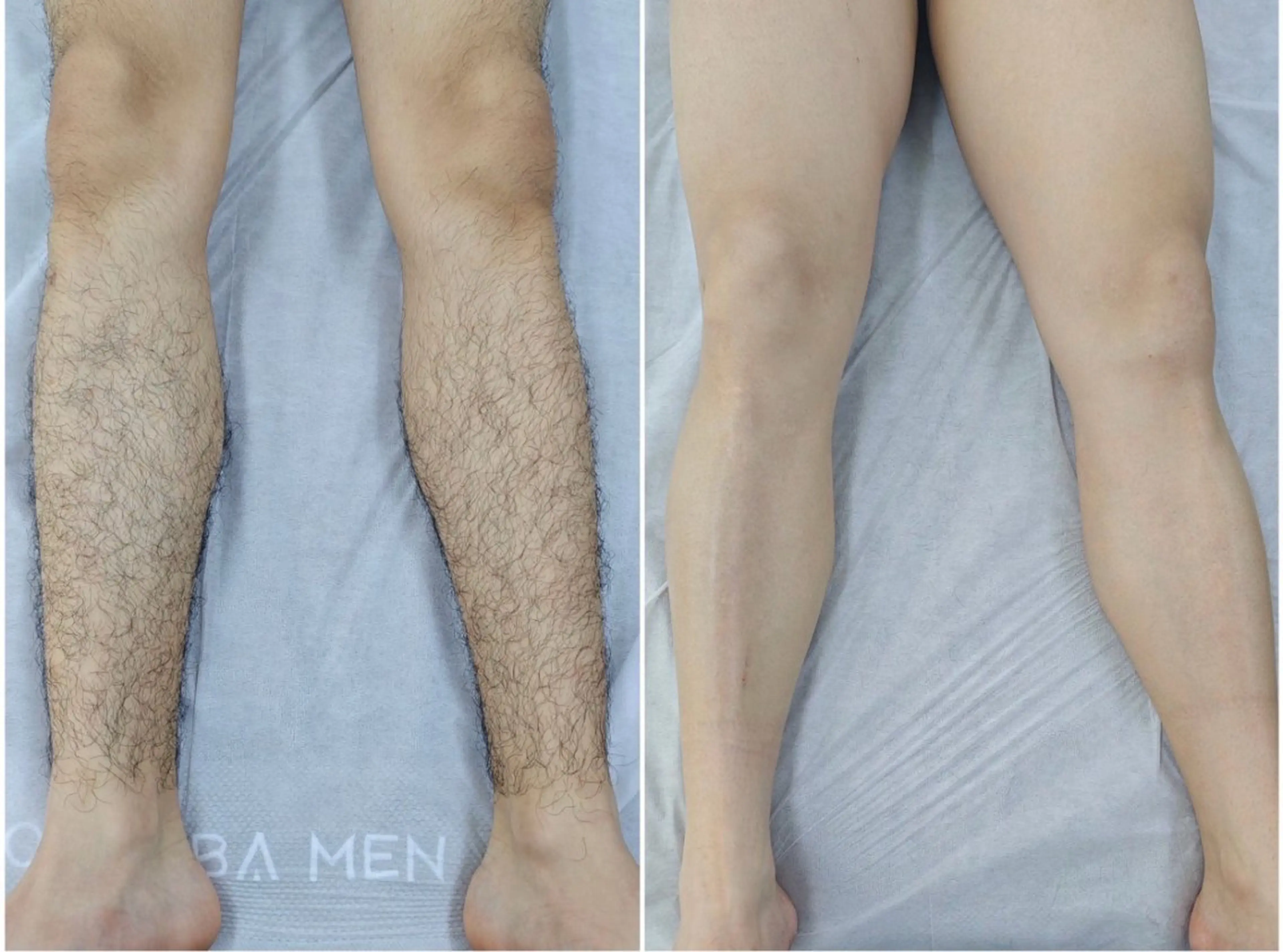 メンズ エルモサ痩身脱毛 西八王子店のエステ・リラクイメージ