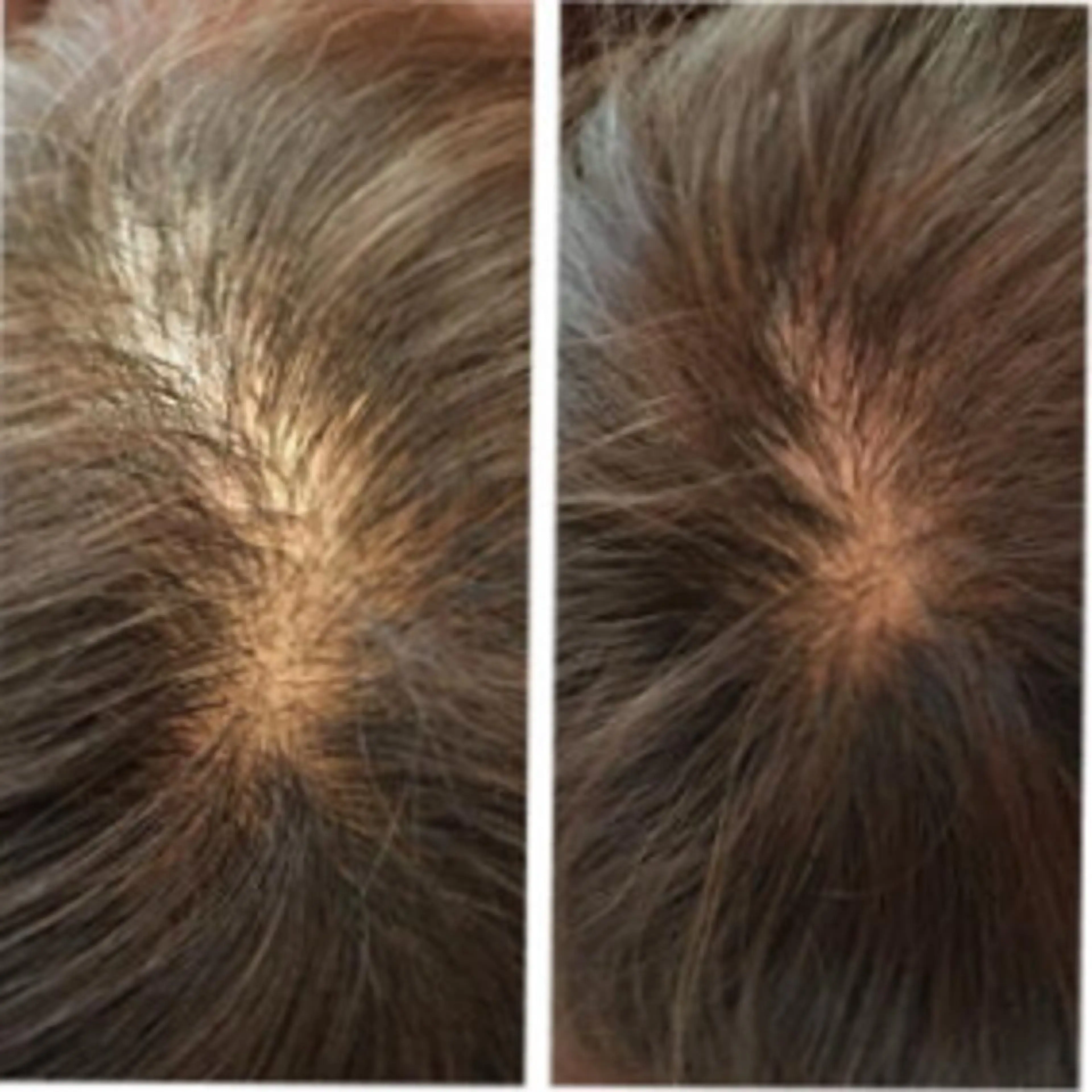 育毛ヘッドスパ＆エクステンション☆気軽に増毛体験☆の写真