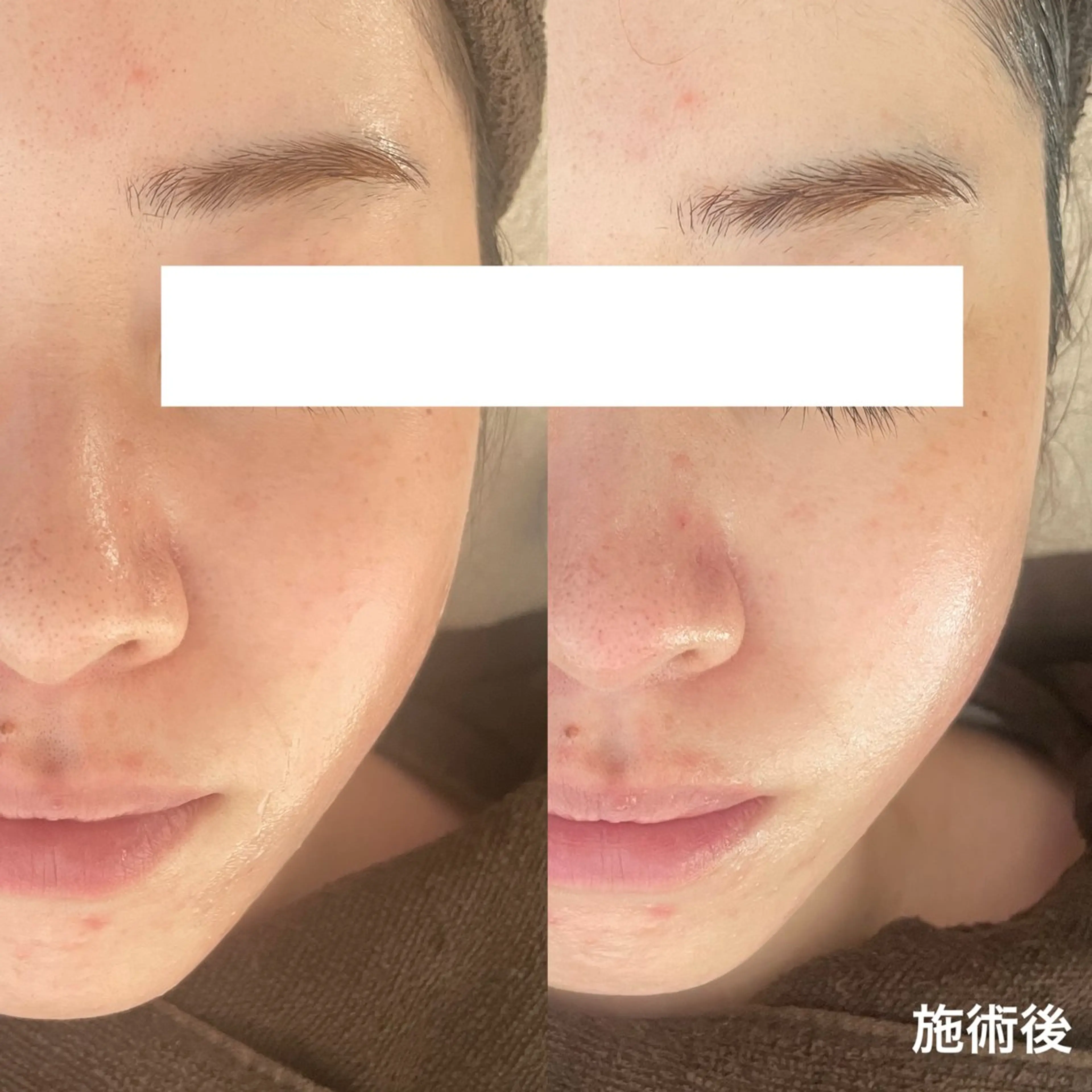 エステ サロンドフルベール 折尾店のエステ・リラクイメージ