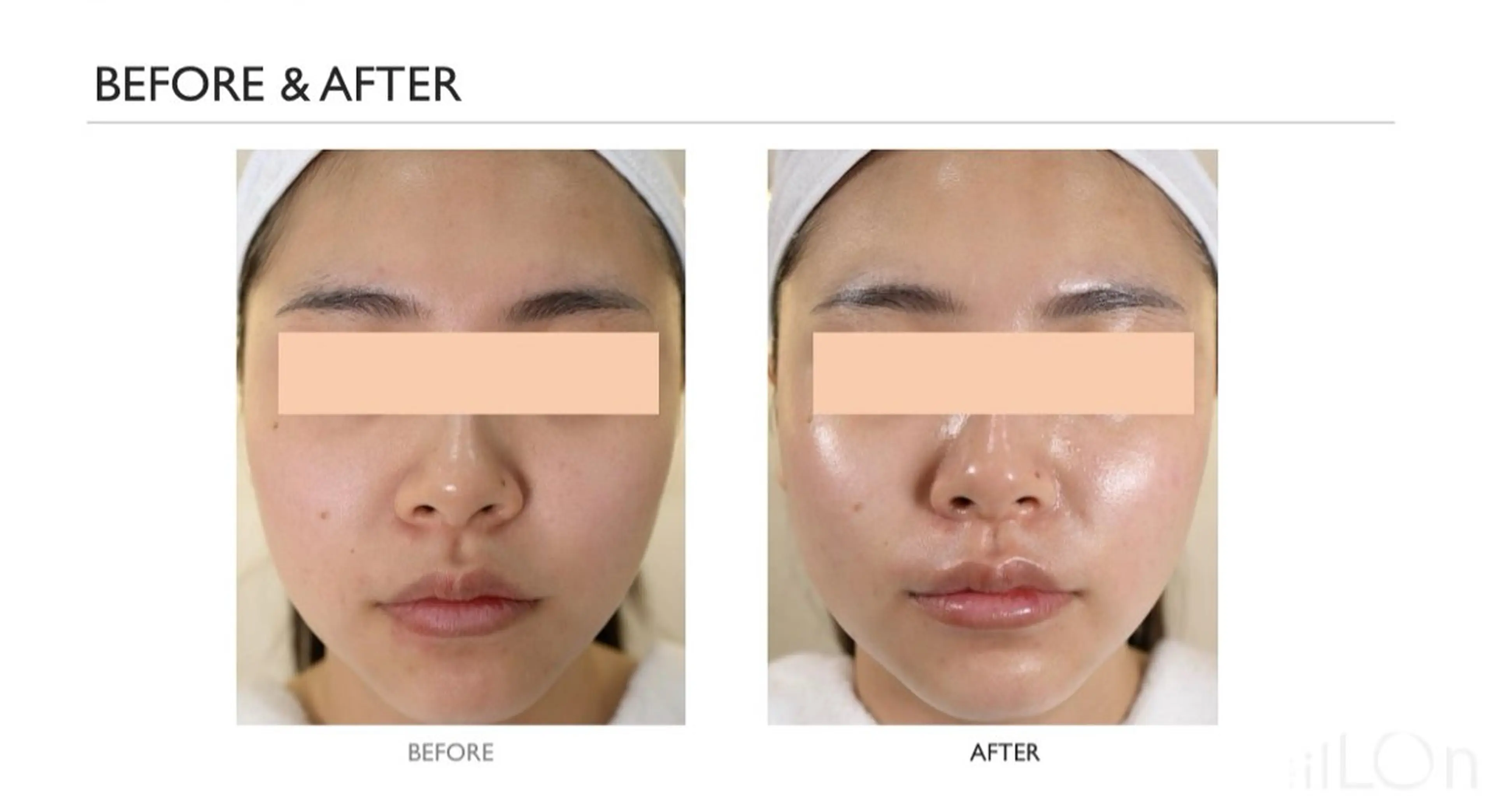 Myuraオーナー MIYUのエステ・リラクイメージ