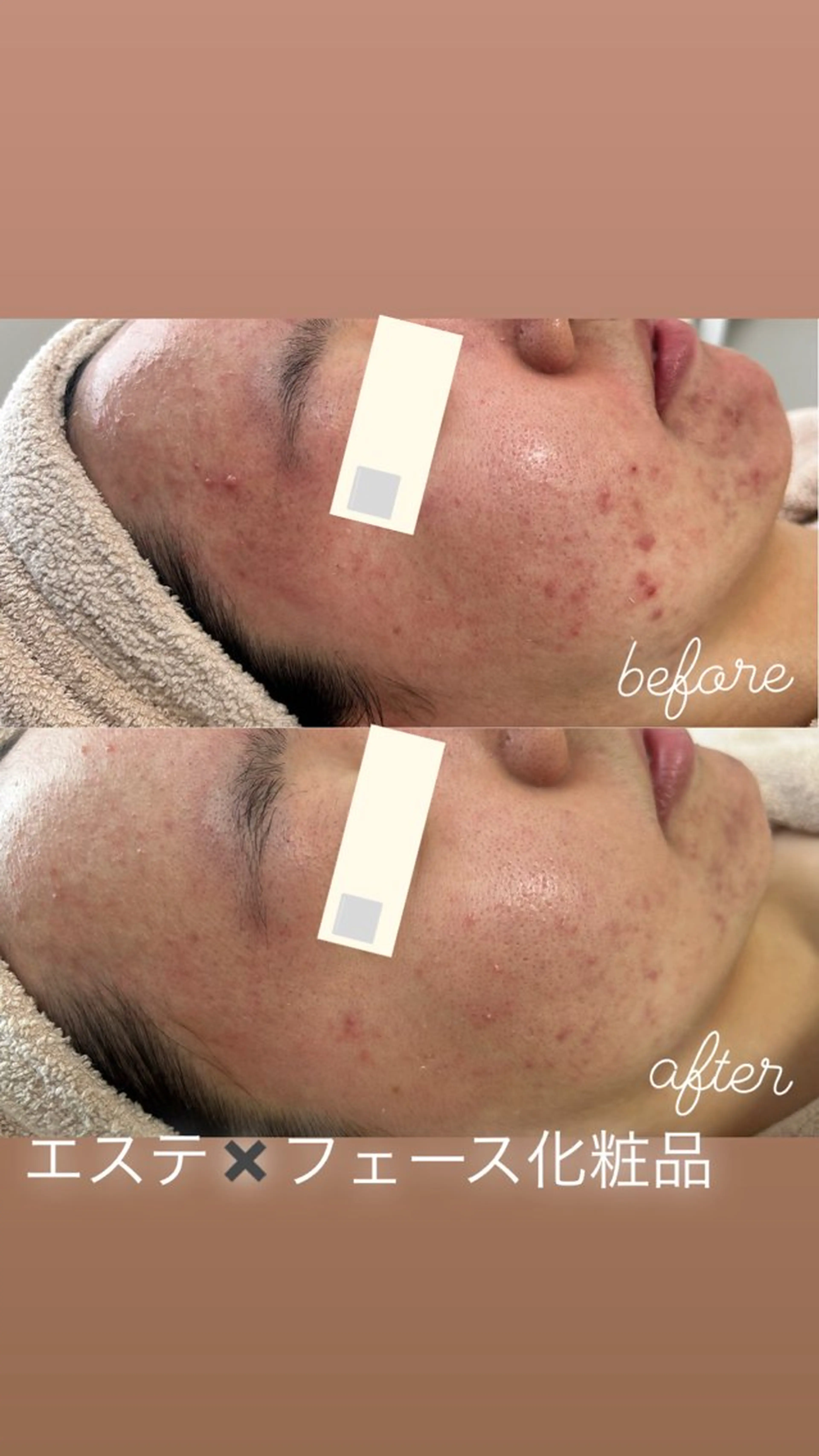 都度払い肌改善専門店 店長二上文香のエステ・リラクイメージ