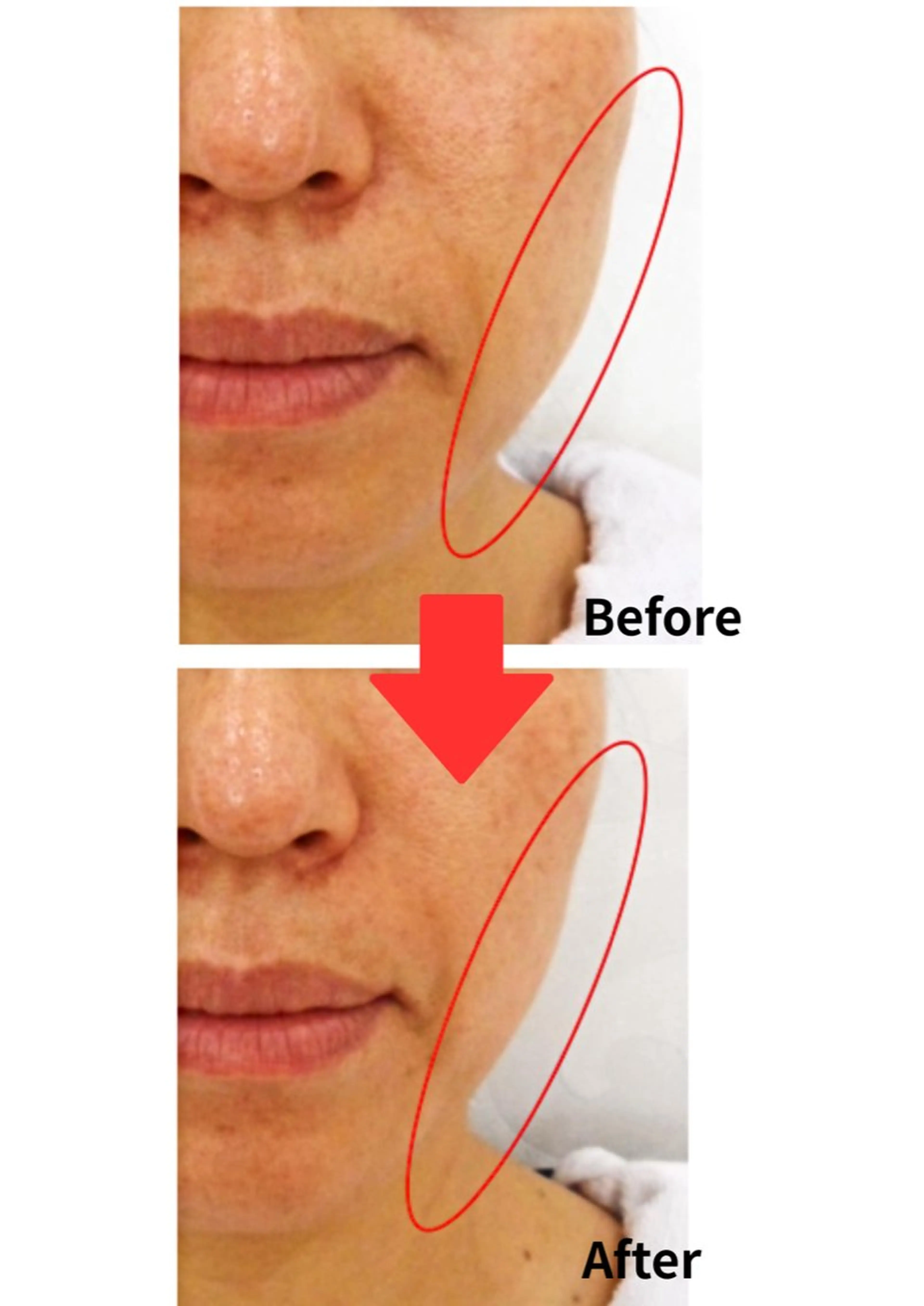 本格痩身＊透明美肌 BelleWhiteのエステ・リラクイメージ