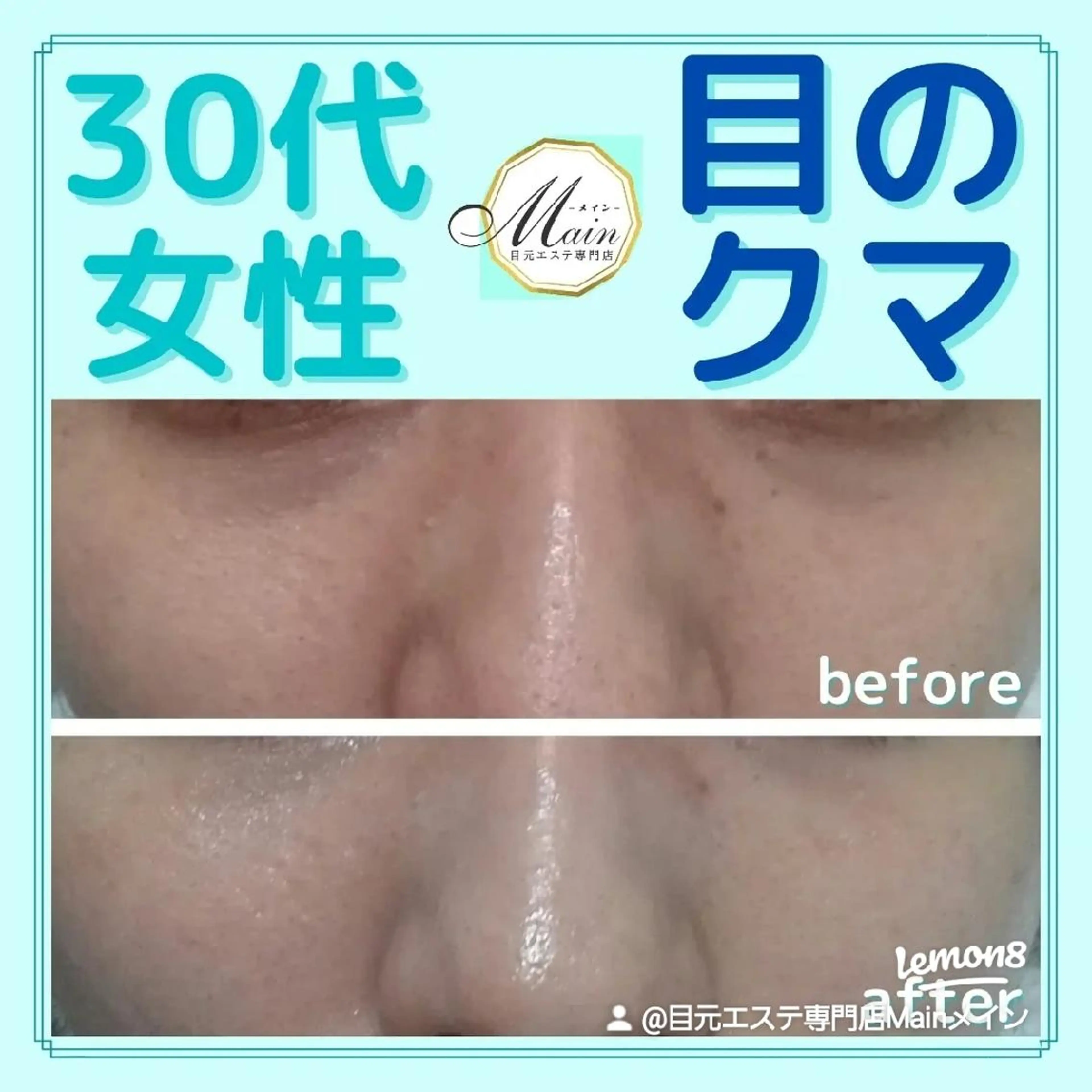 エステ 目元エステ専門店  Main(メイン)所属・Main 高野のエステ・リラクイメージ