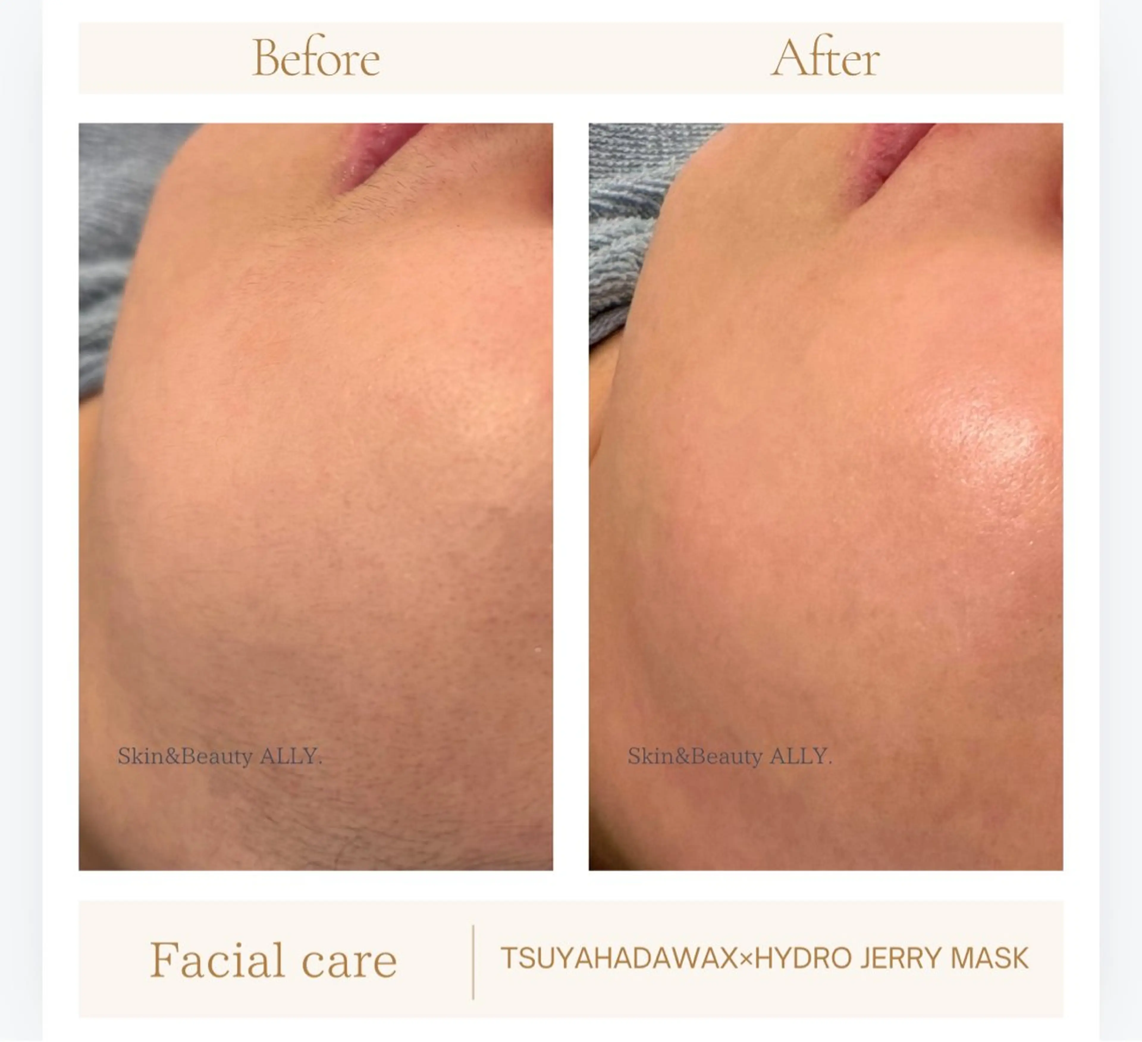 エステ 艶肌ワックス ALLY.のエステ・リラクイメージ