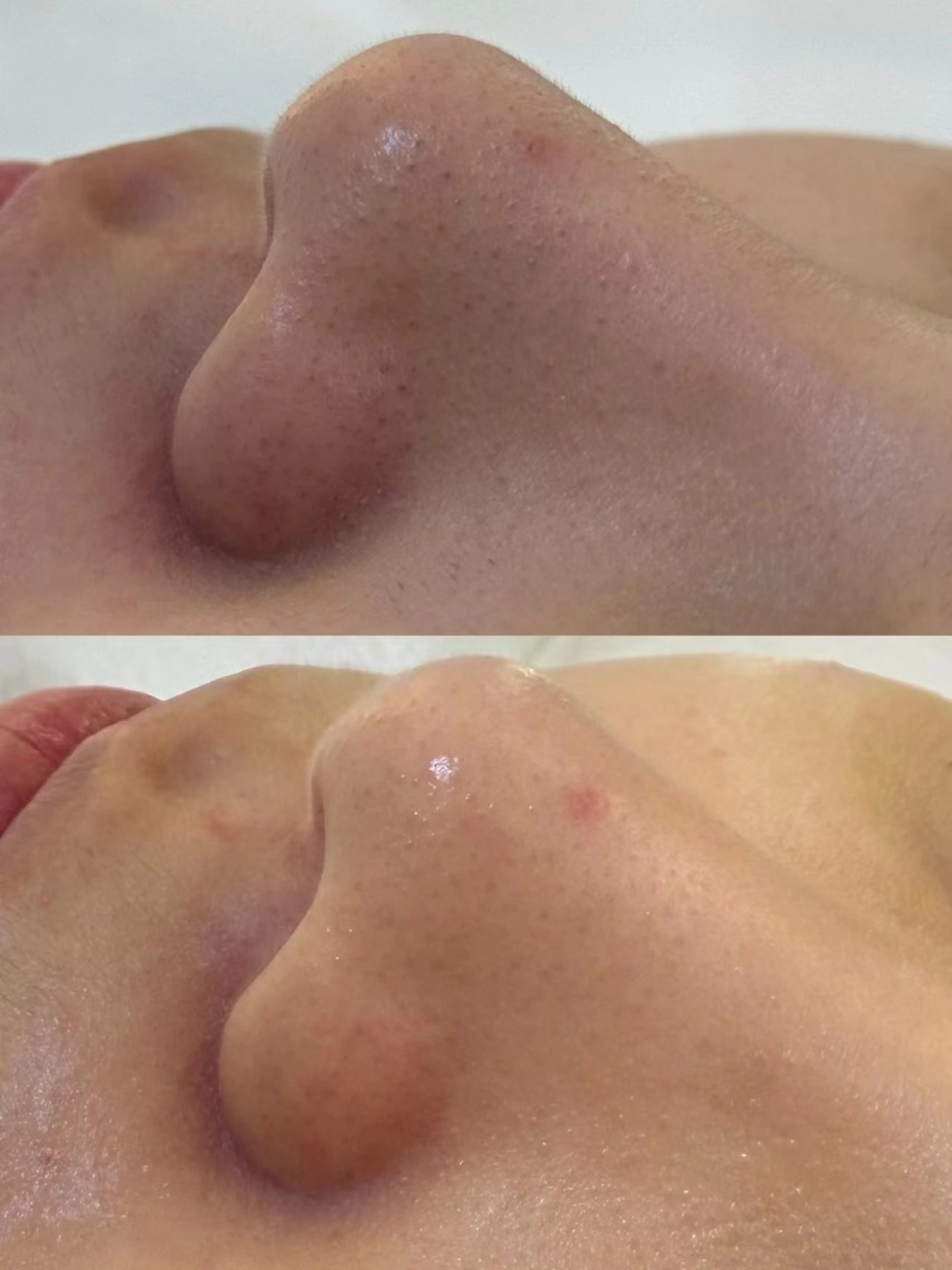 エステ ホワイトビューティ サロンのエステ・リラクイメージ