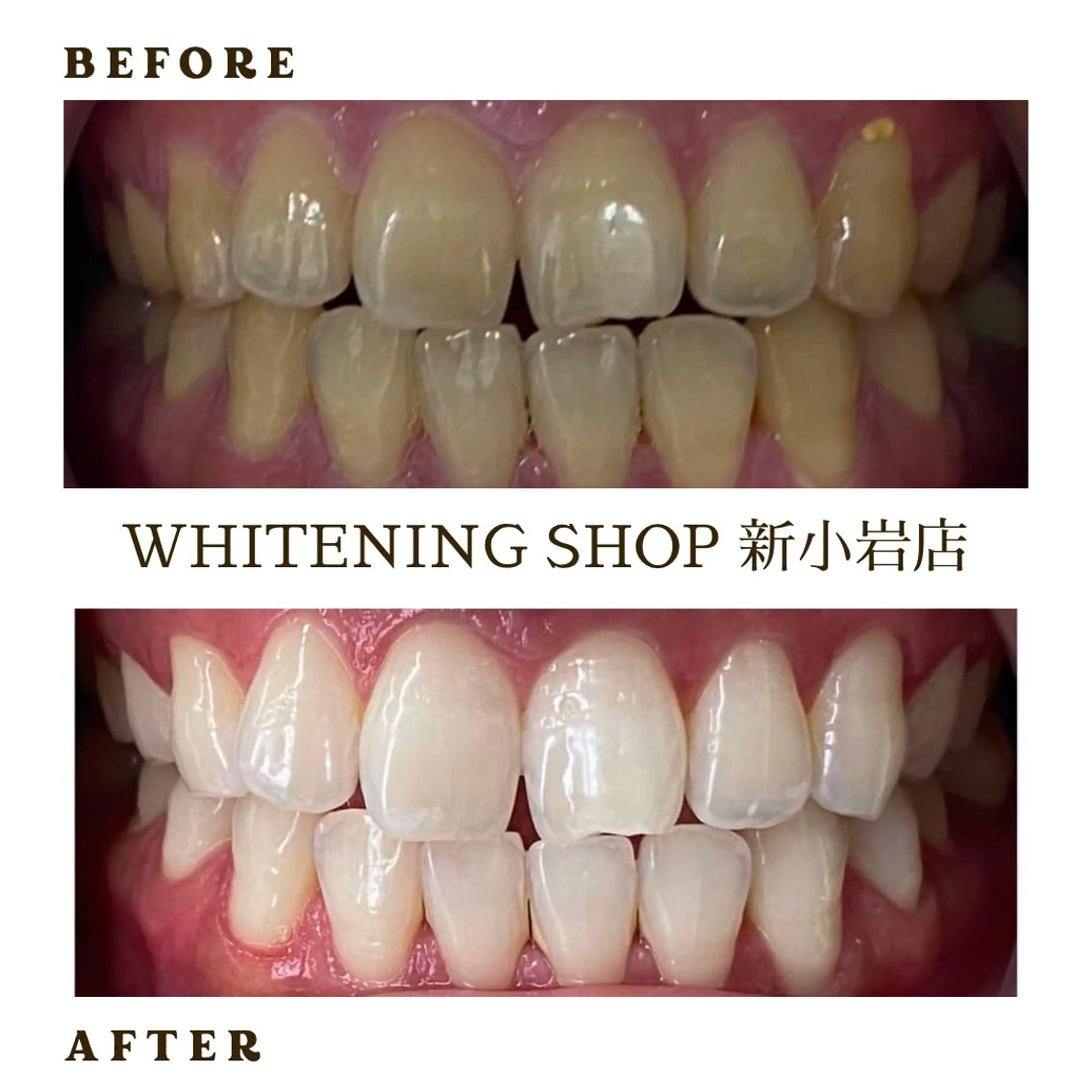 メンズ その他 ホワイトニング ショップ新小岩店のその他イメージ
