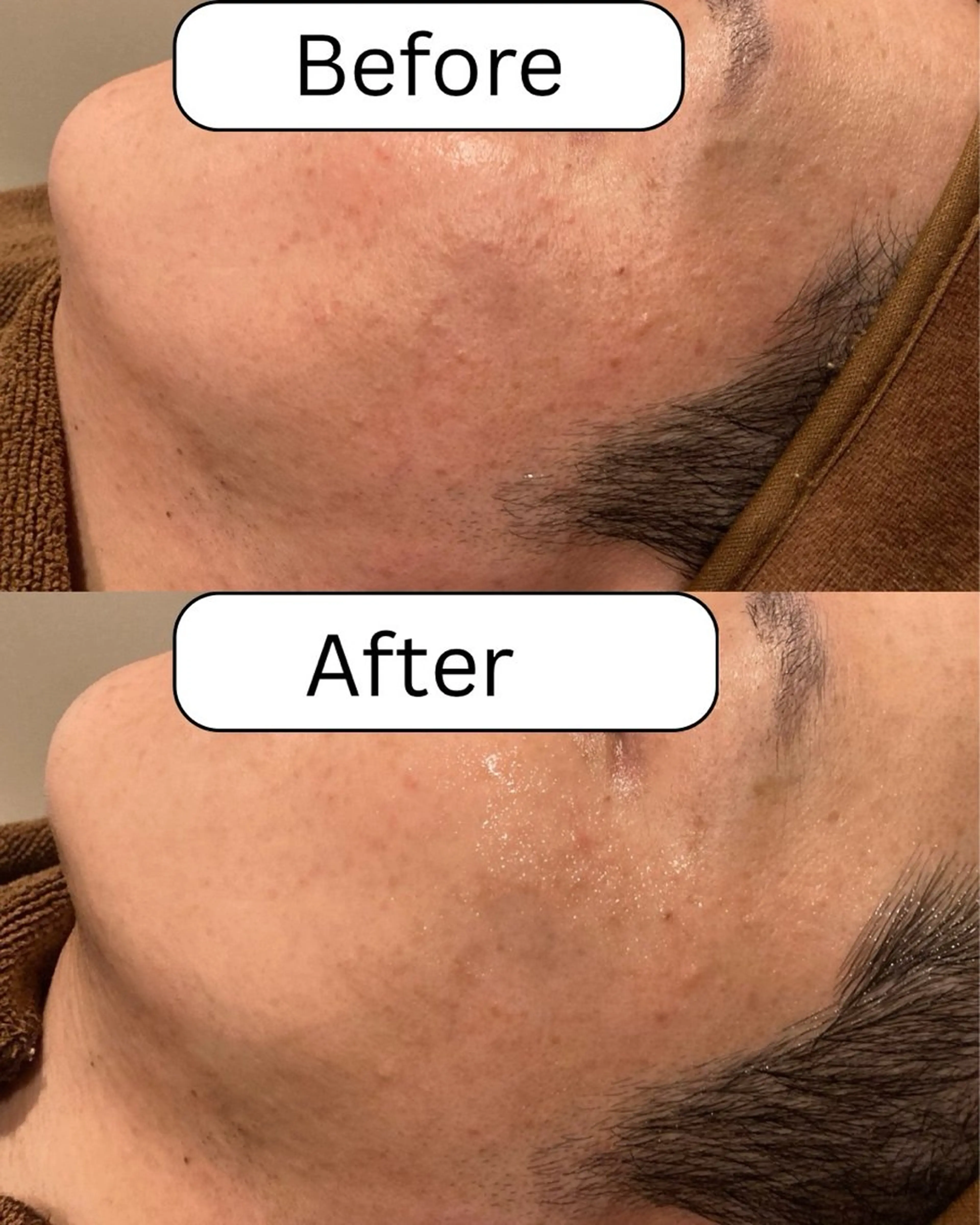 南森町・肌質改善 BELMIMARのエステ・リラクイメージ