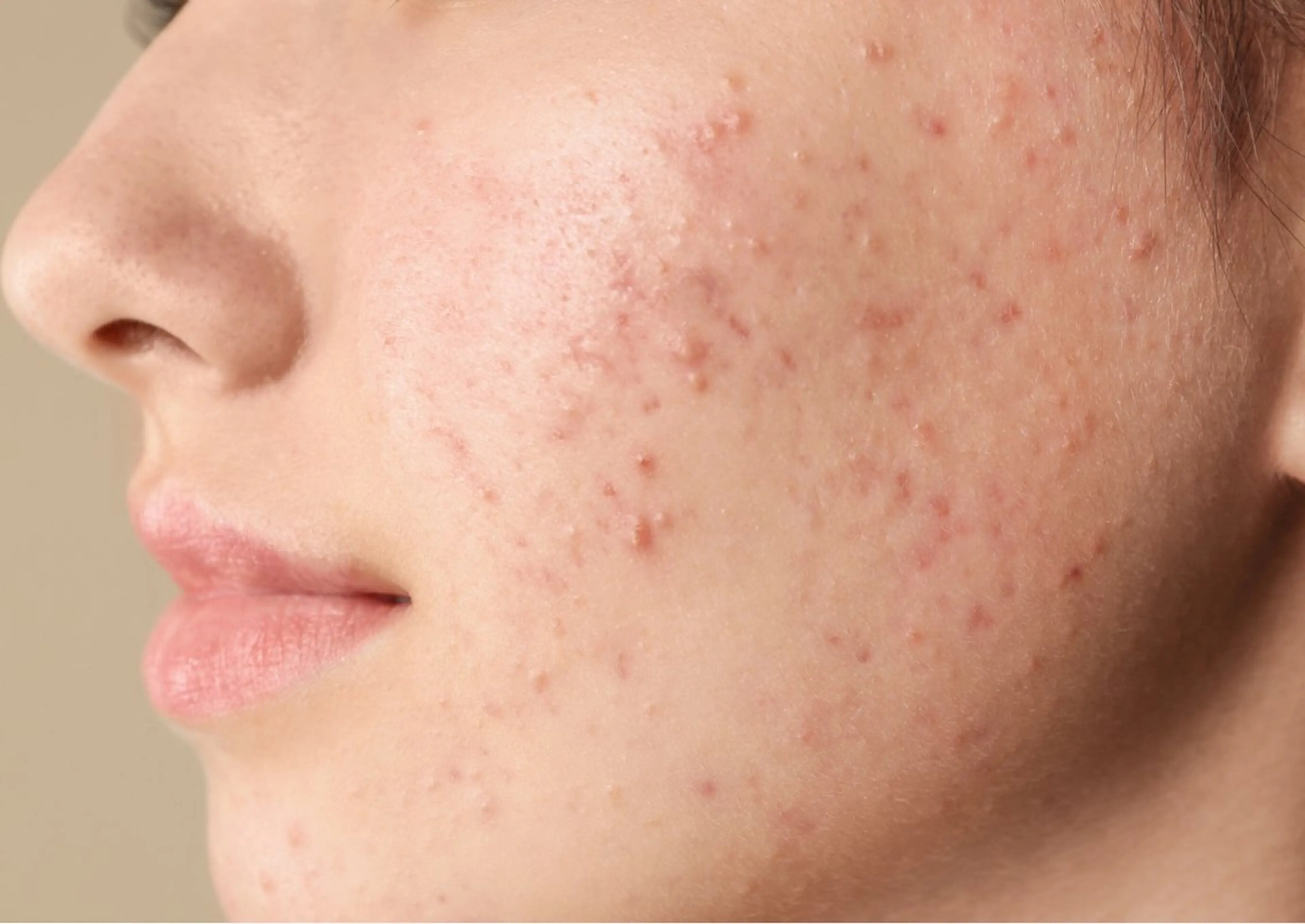 エステ Luu HANARE 和モダンサロンのエステ・リラクイメージ