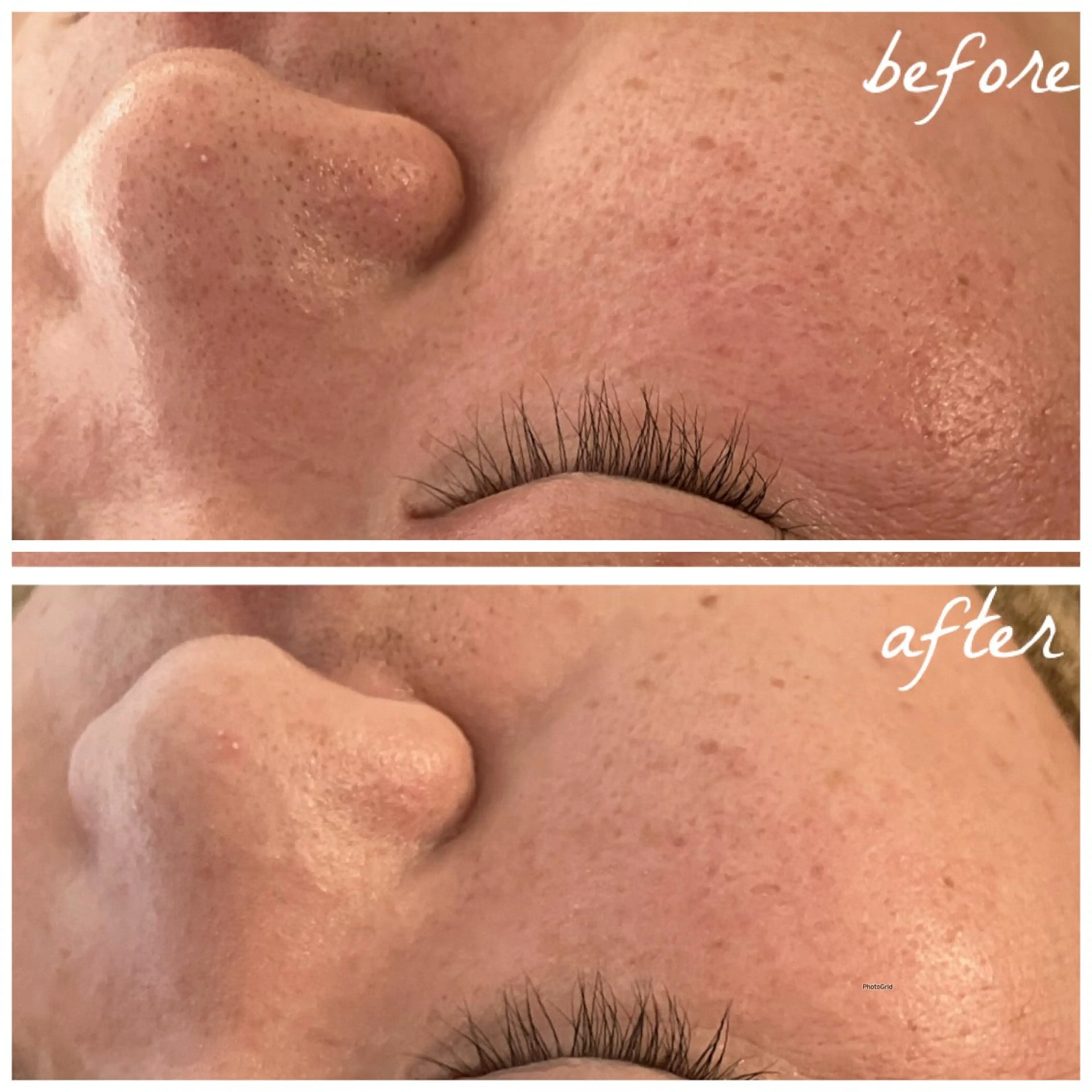 メンズ エステ メナード岐阜市茜部 杉浦のエステ・リラクイメージ