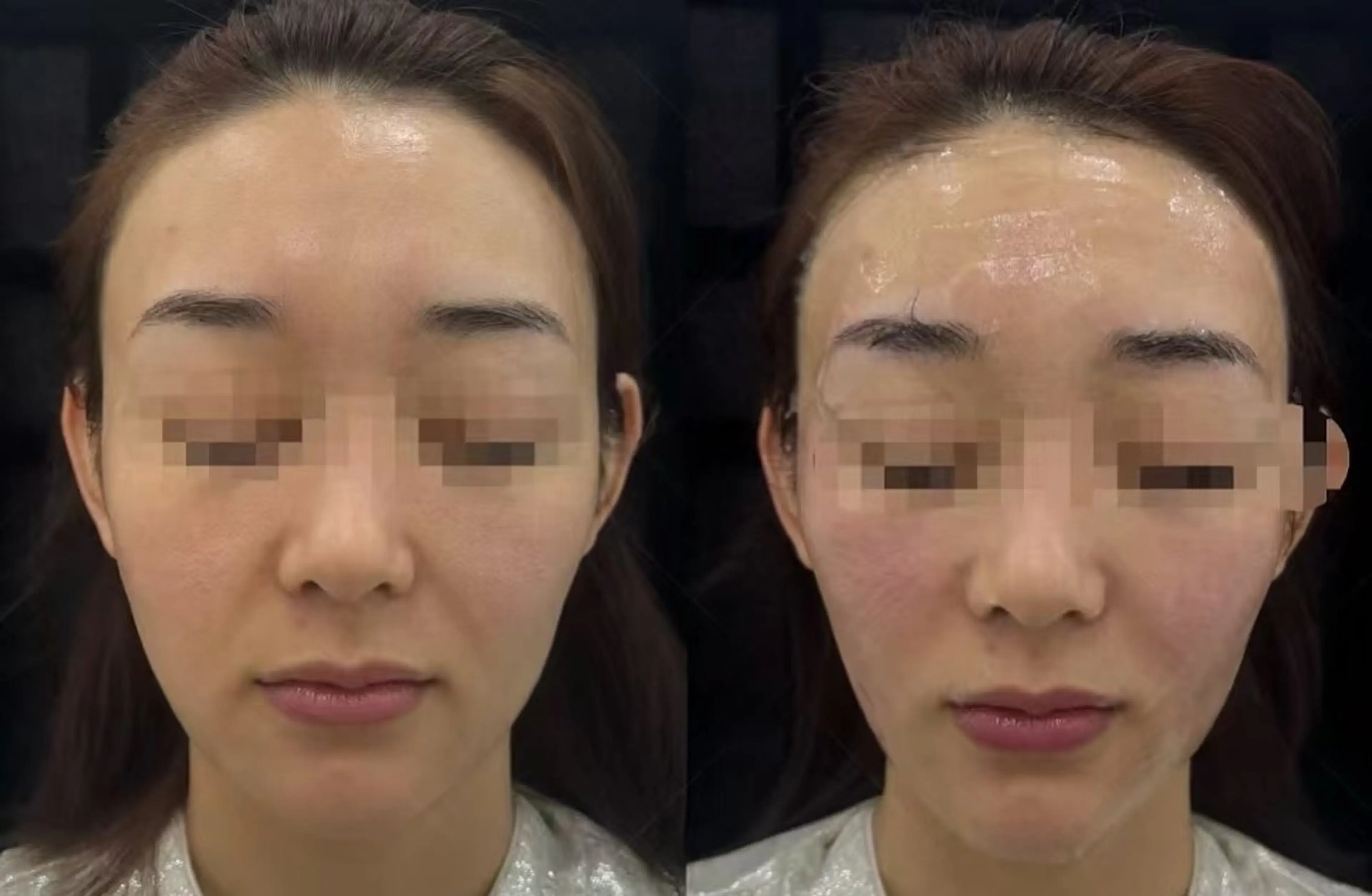 マツエク・マツパ 結婚式・ブライダル aliaハーブ水光店 エステティシャン募集のエステ・リラクイメージ