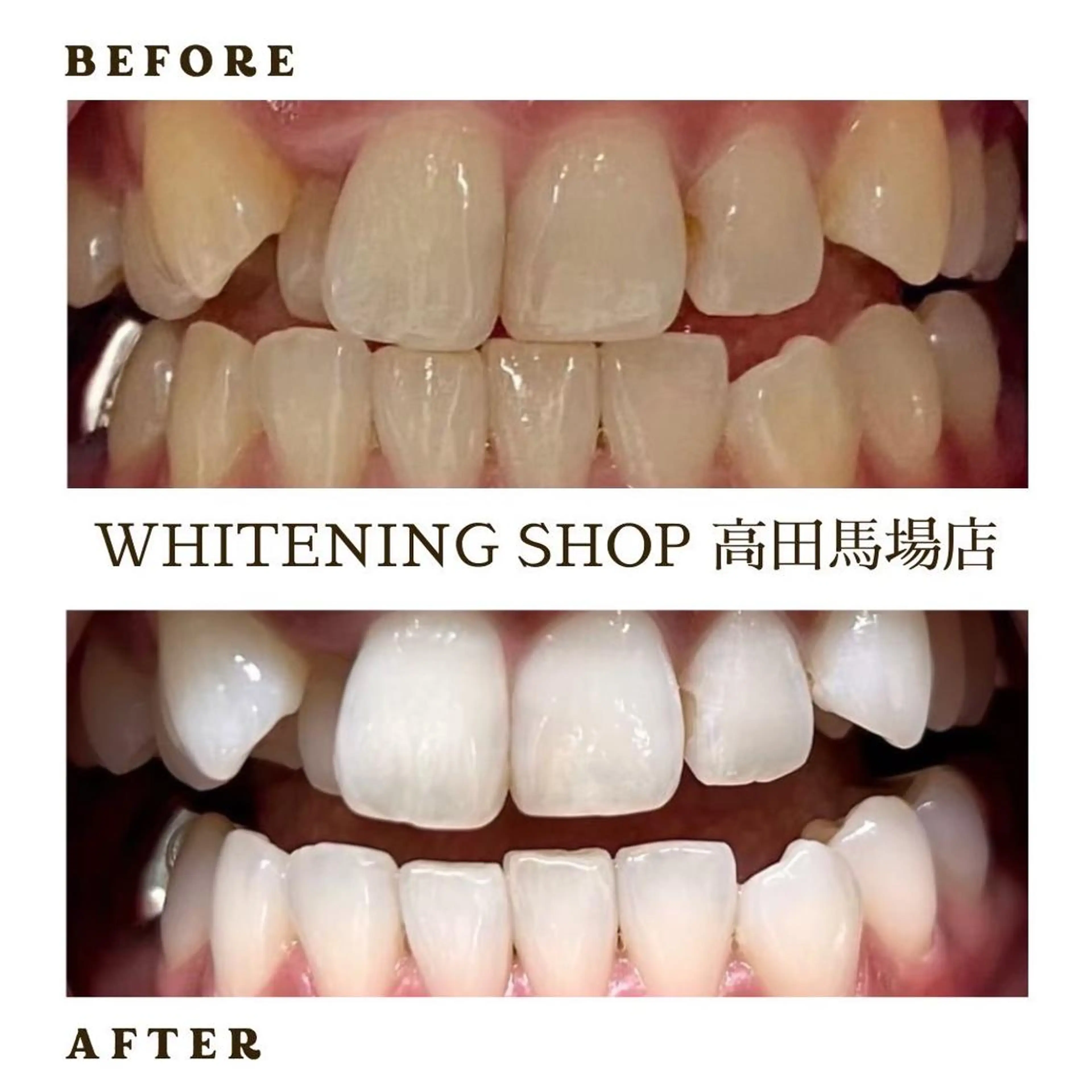 メンズ その他 ホワイトニング ショップ高田馬場店のその他イメージ