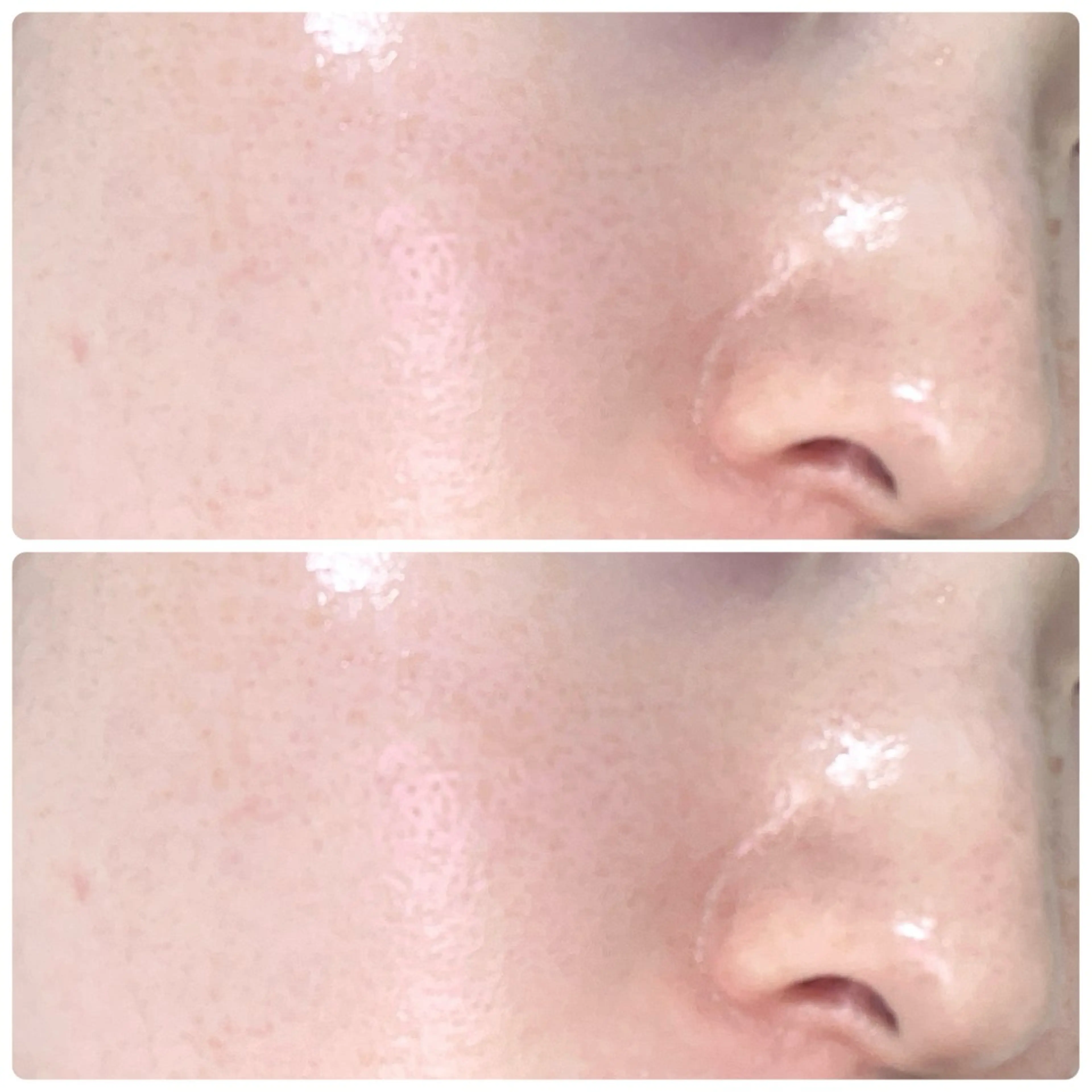 【韓国肌管理✨️最新第四世代ピーリング】 ララピール￥9300の写真