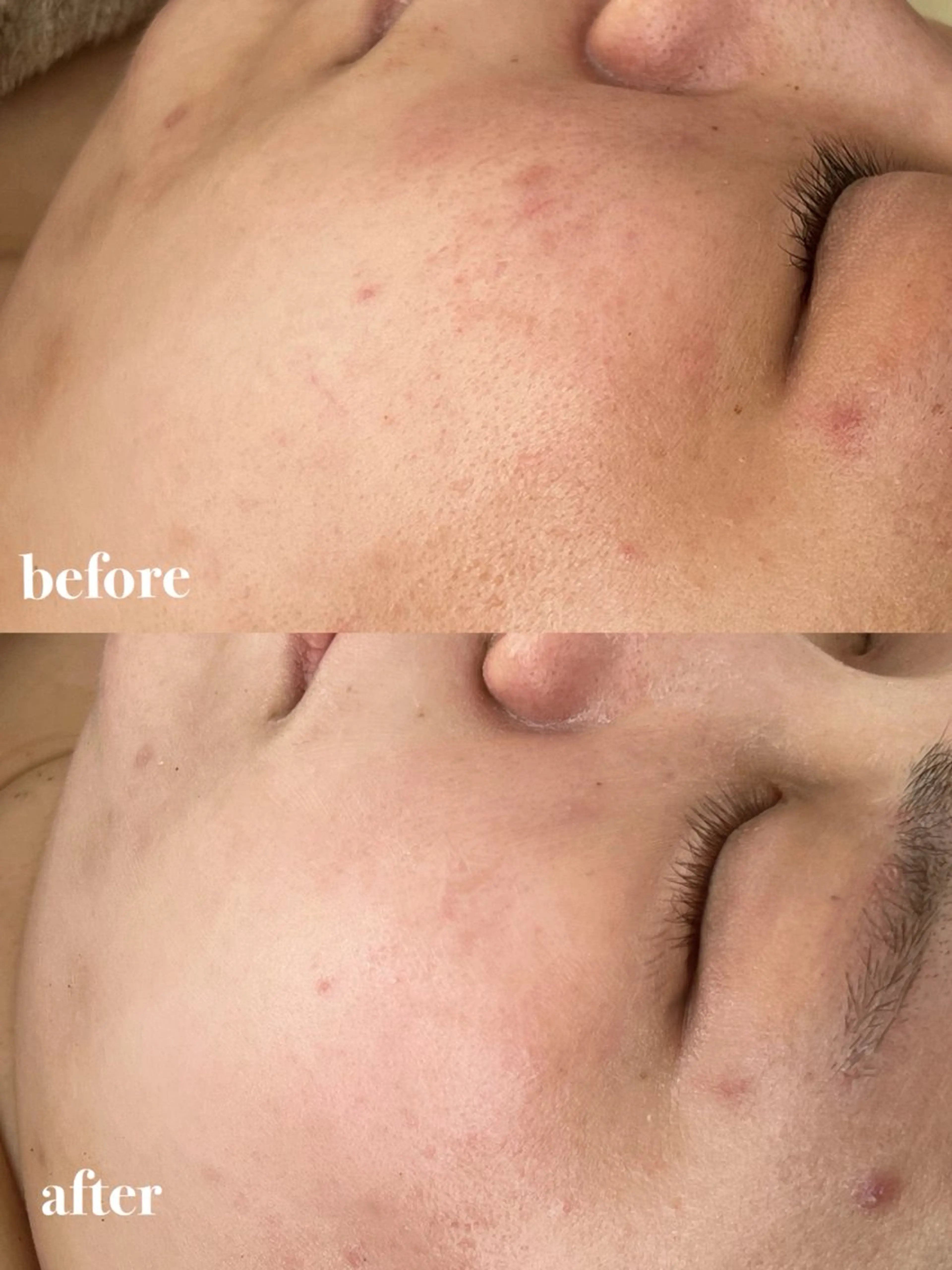 エステ ohana所属・河合 菜月のエステ・リラクイメージ