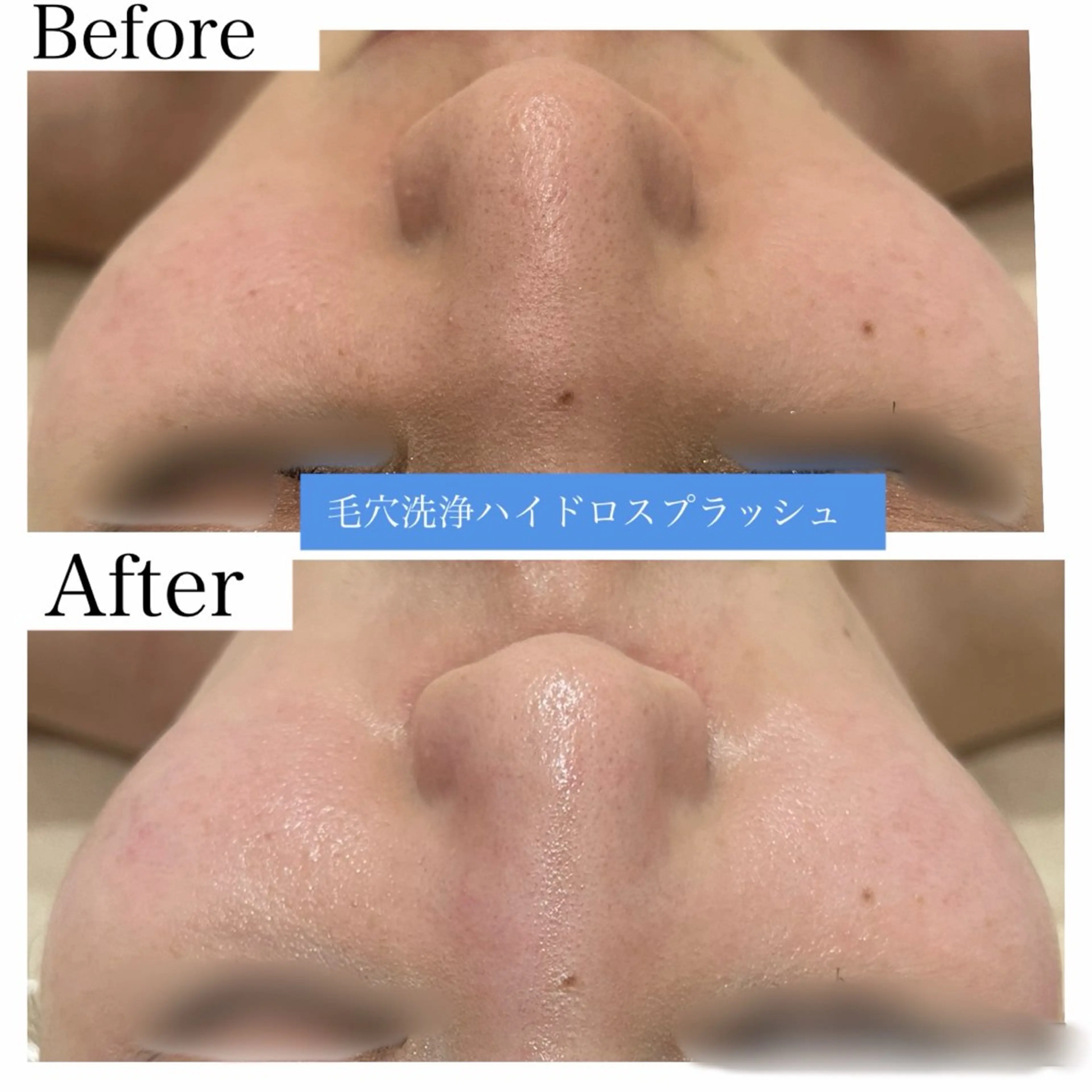 エステ ブライダル痩身×脱毛 尼崎駅前サロンのエステ・リラクイメージ