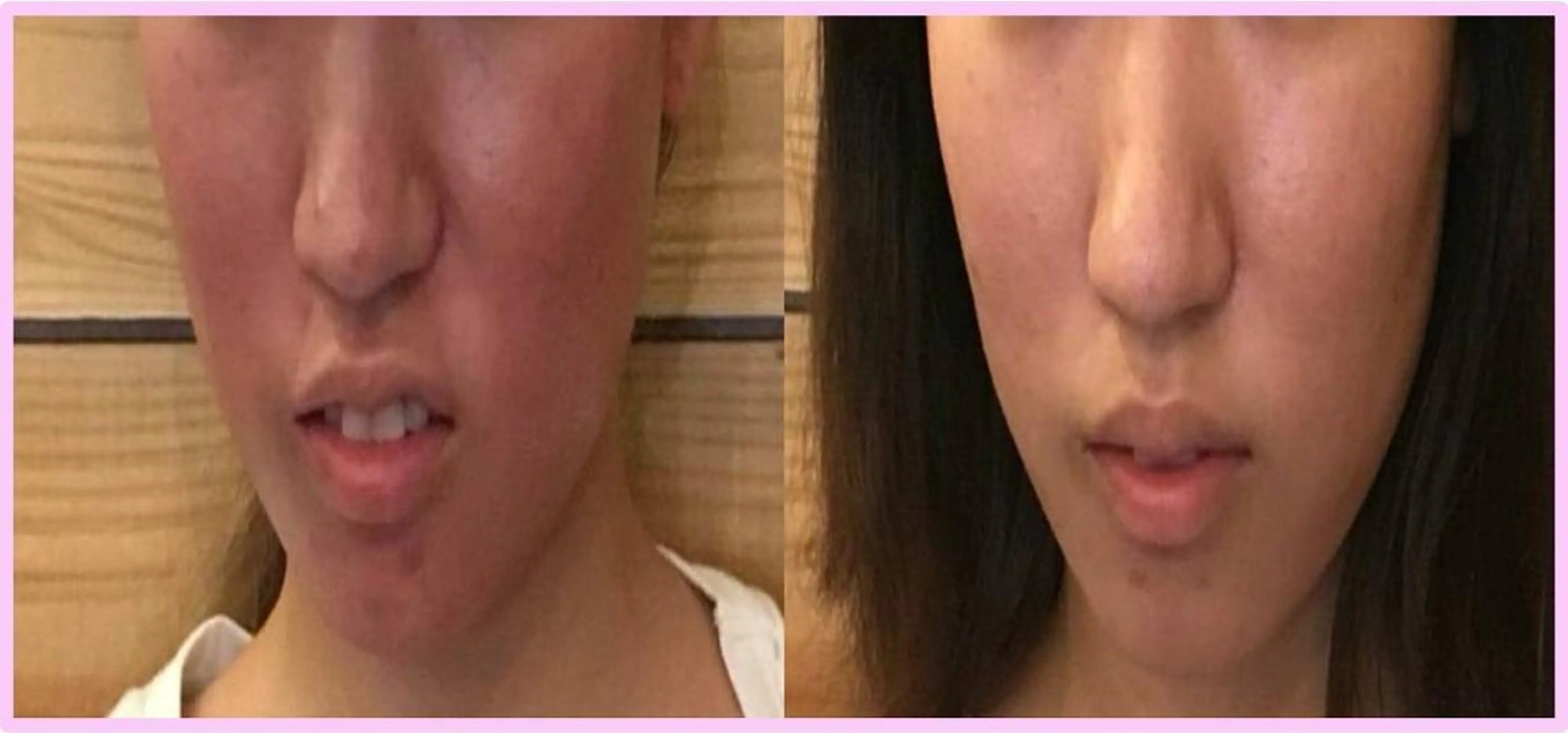 エステ リラク HARIS(ハリス) 院長Shimのエステ・リラクイメージ