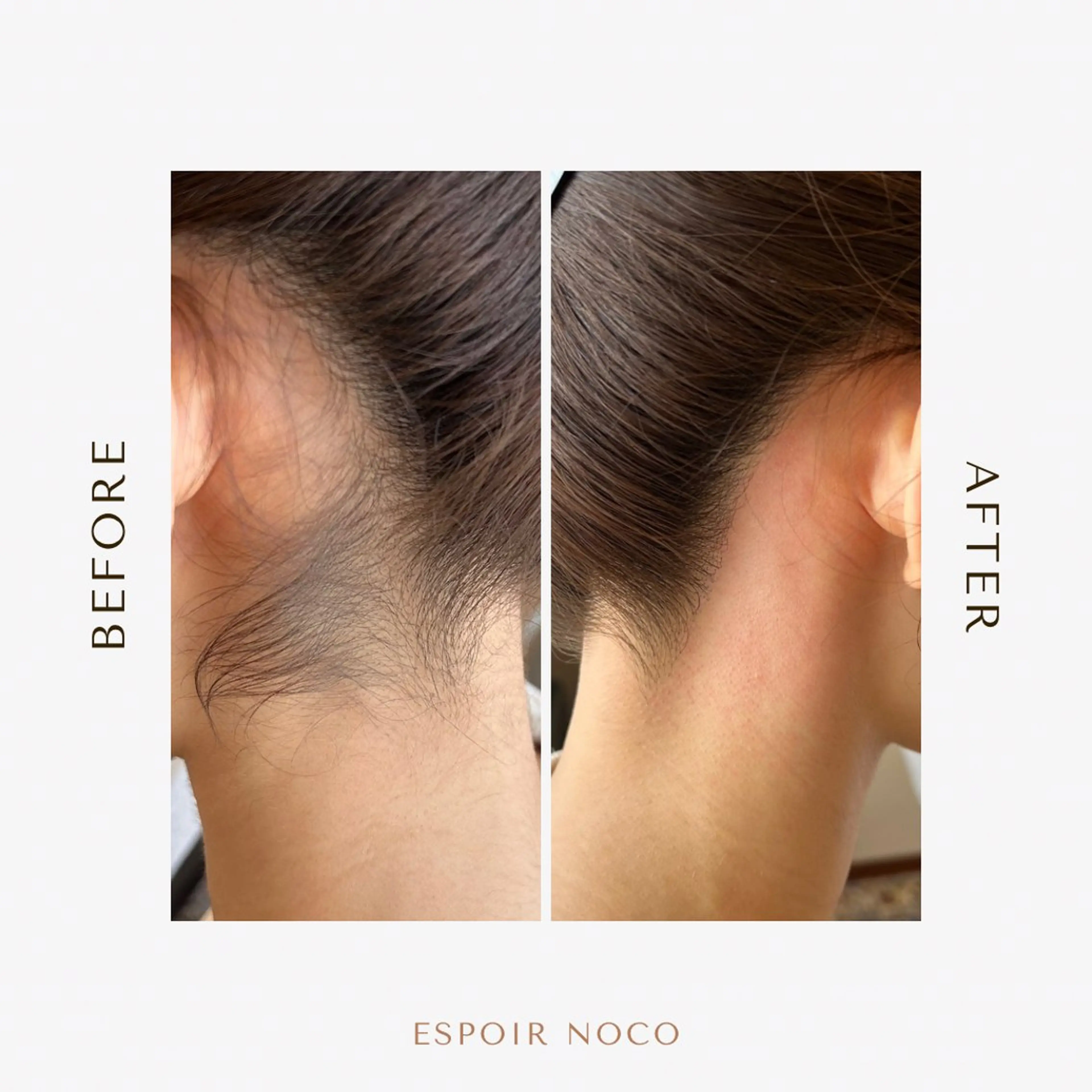 ワックス脱毛🌈 ESPOIRnocoのエステ・リラクイメージ