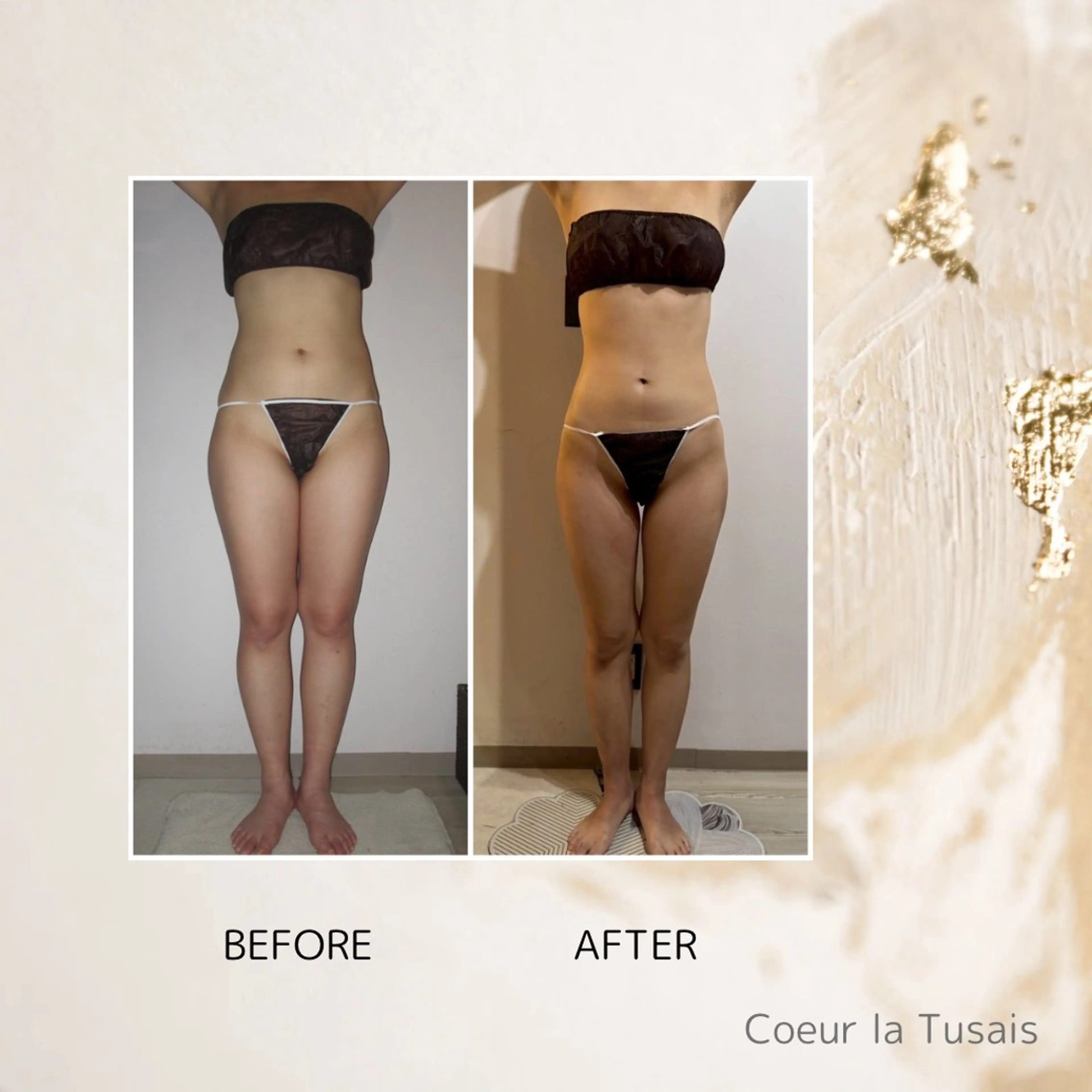 【3回チケット】全身サイズダウンコースの写真