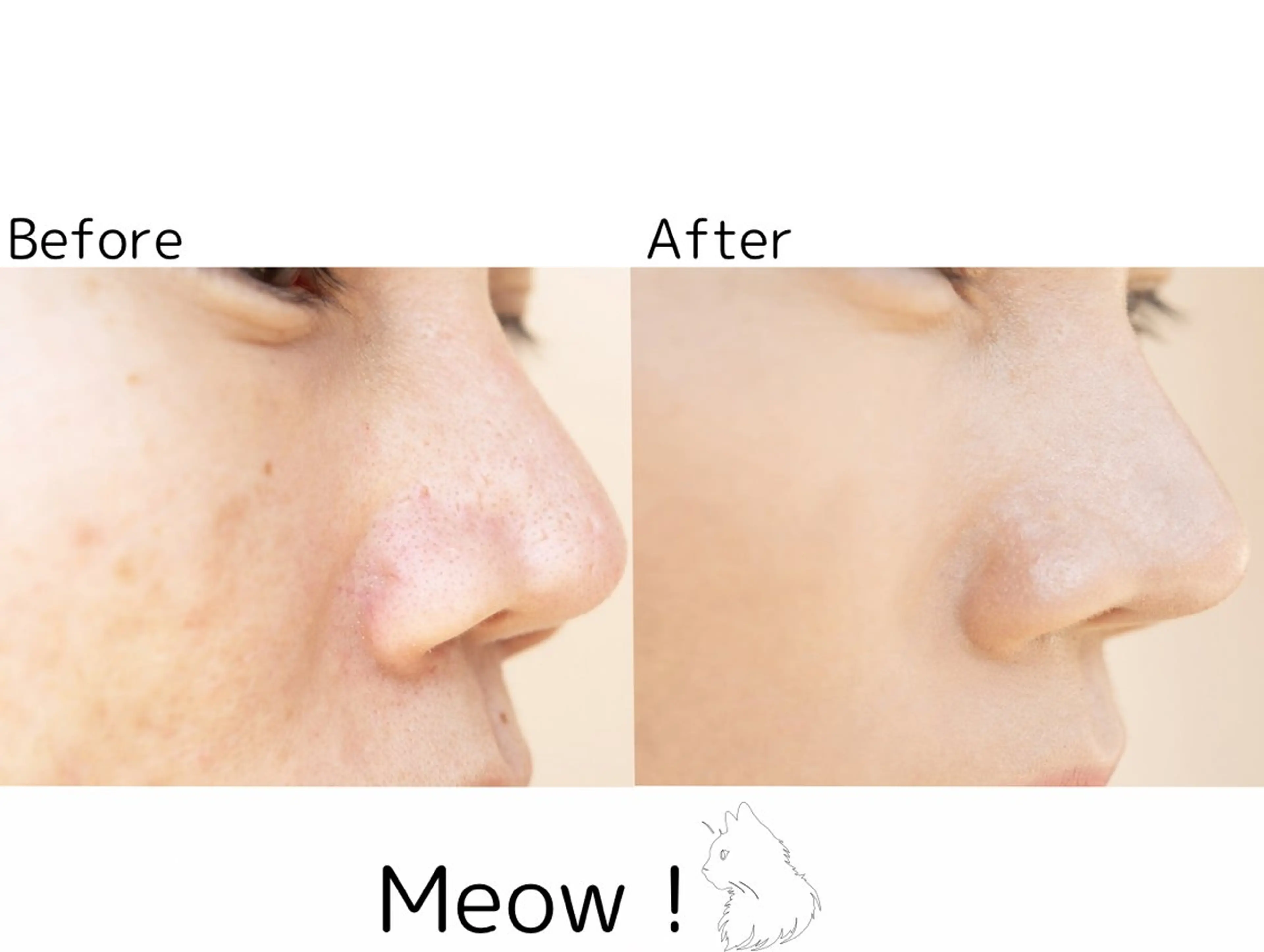エステ トラブル肌改善🏥 Meow！🫧🫧のエステ・リラクイメージ