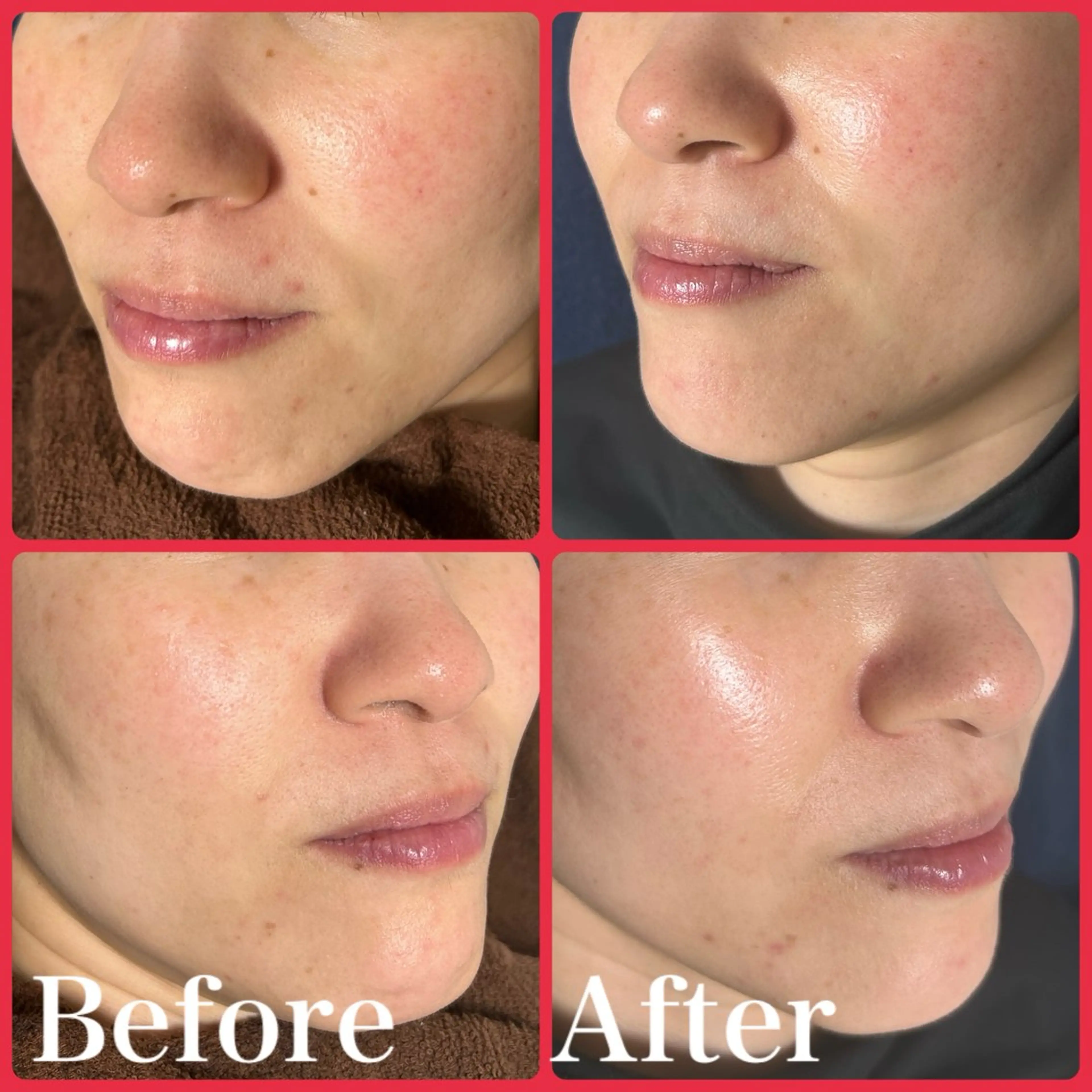 毛穴・肌質改善サロン ✨Tomaのその他イメージ