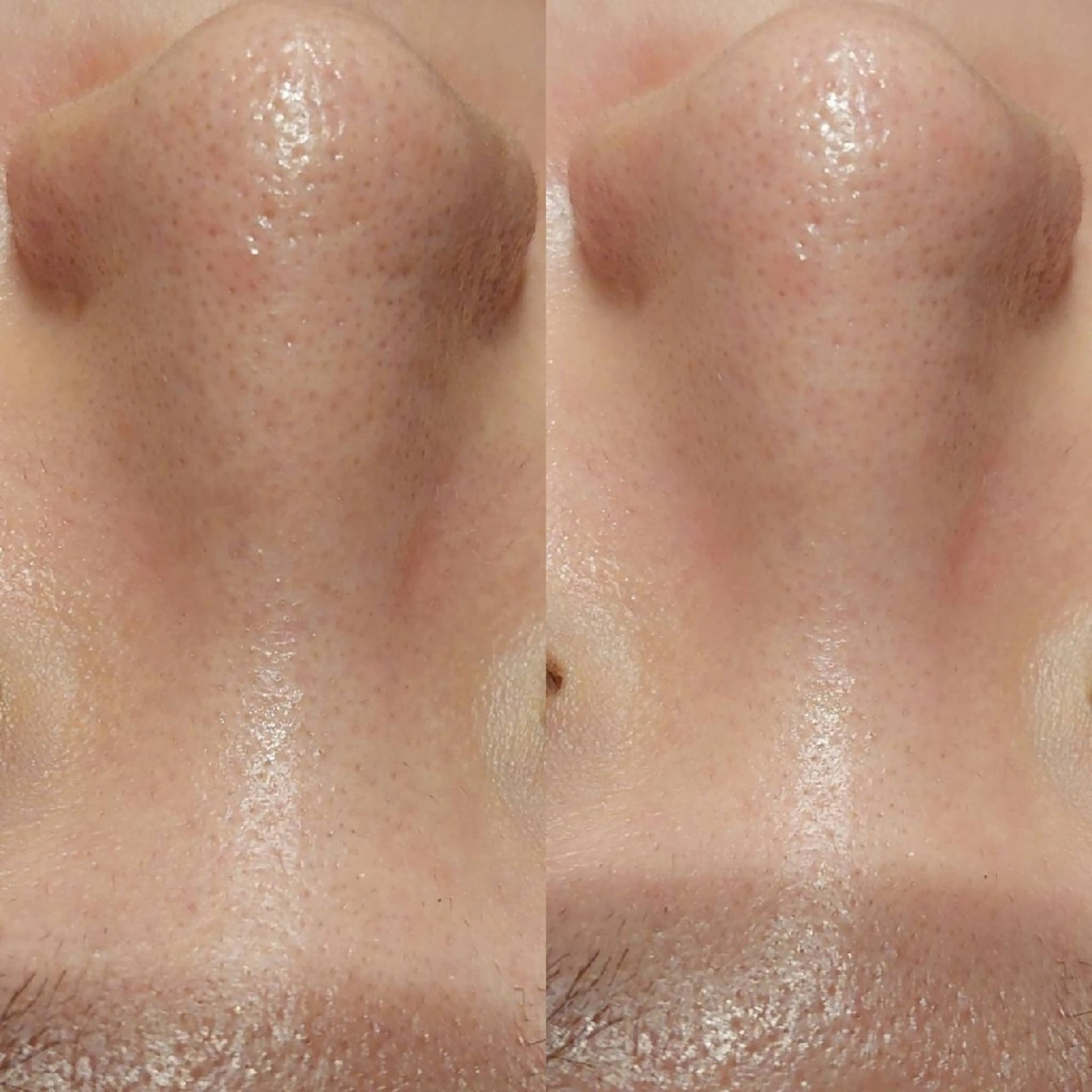 MyFairLady miuのエステ・リラクイメージ