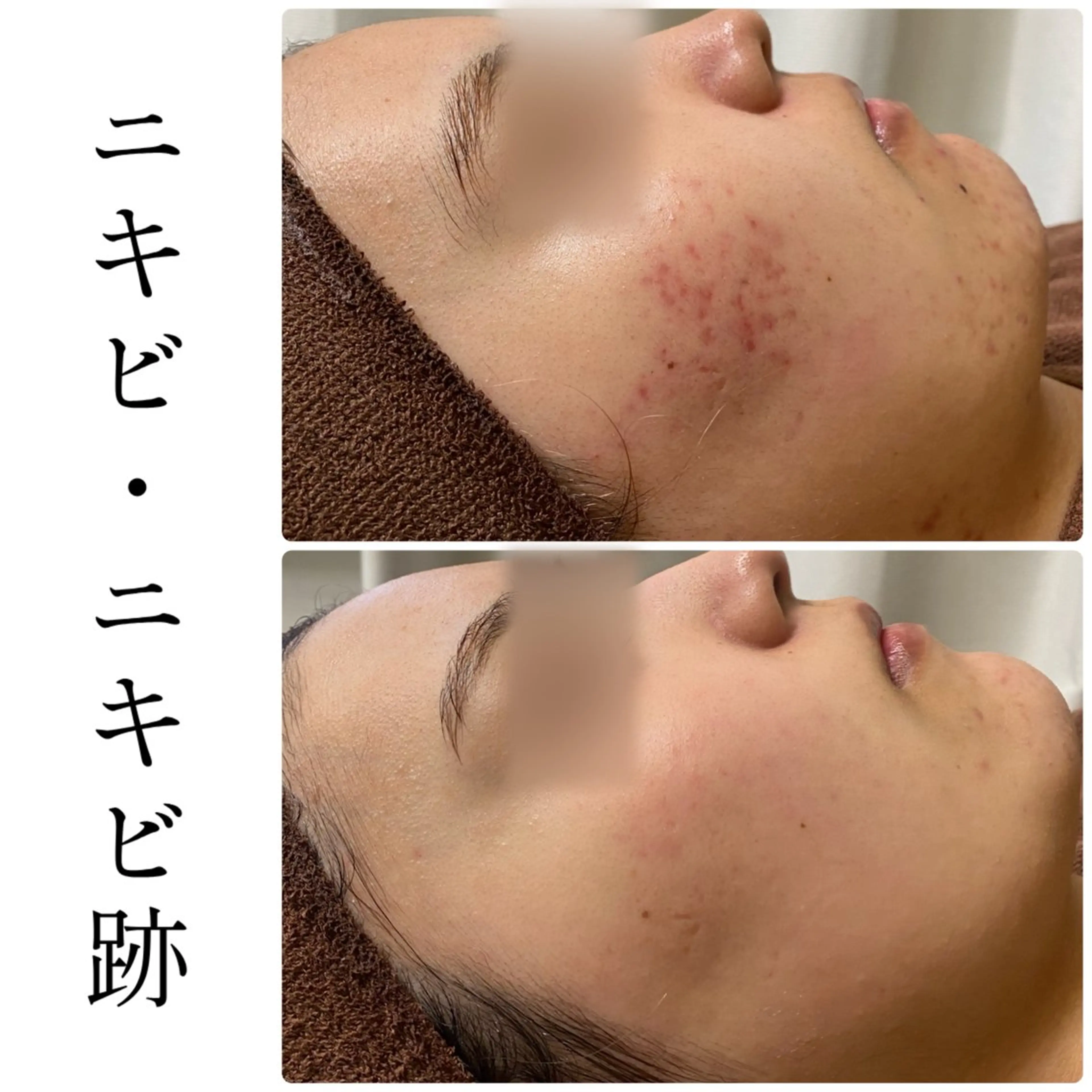 エステ ハーブピーリング専門 BIOEL横浜のエステ・リラクイメージ