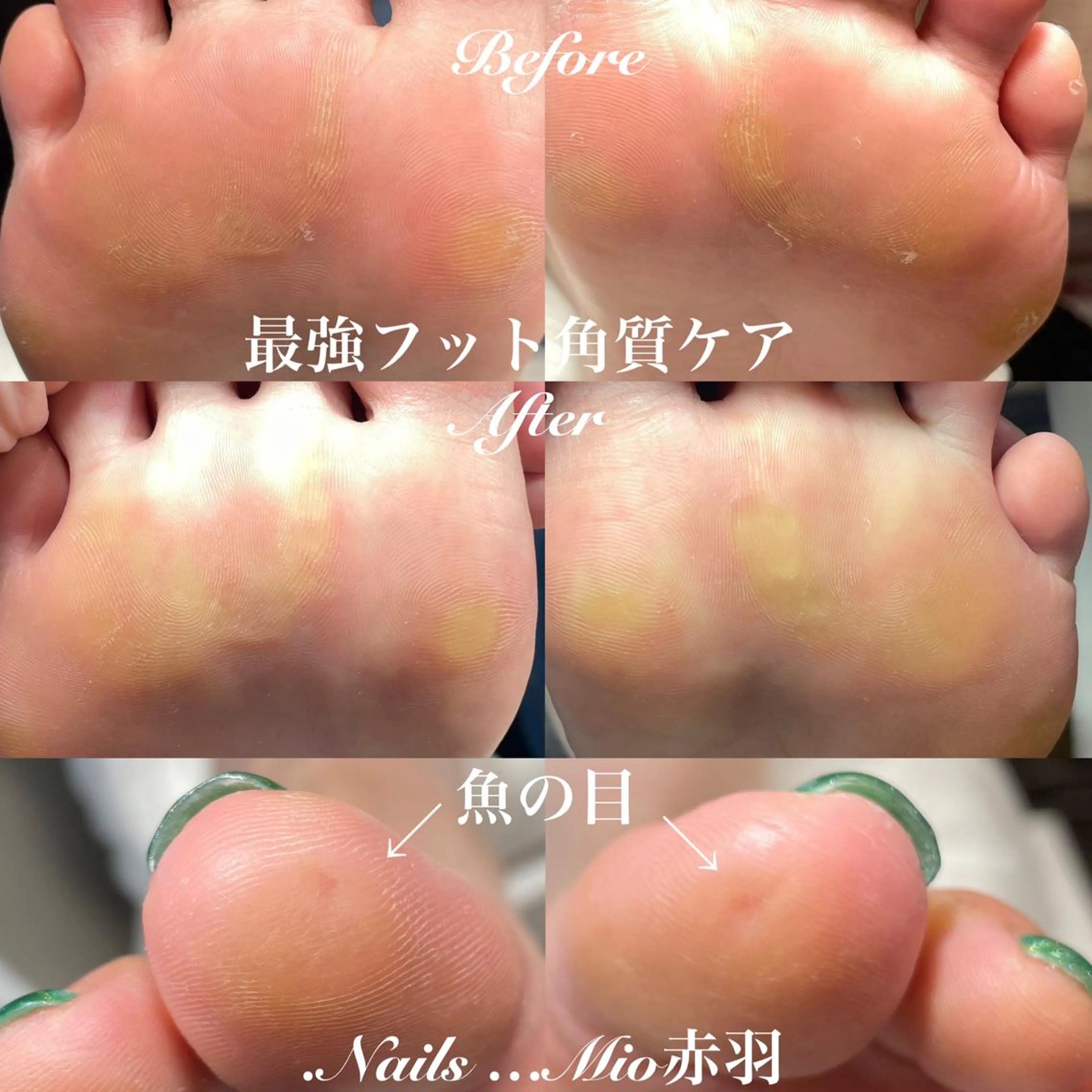 ネイル フットネイル .Nails Mio 赤羽西ネイルサロンのネイルデザイン