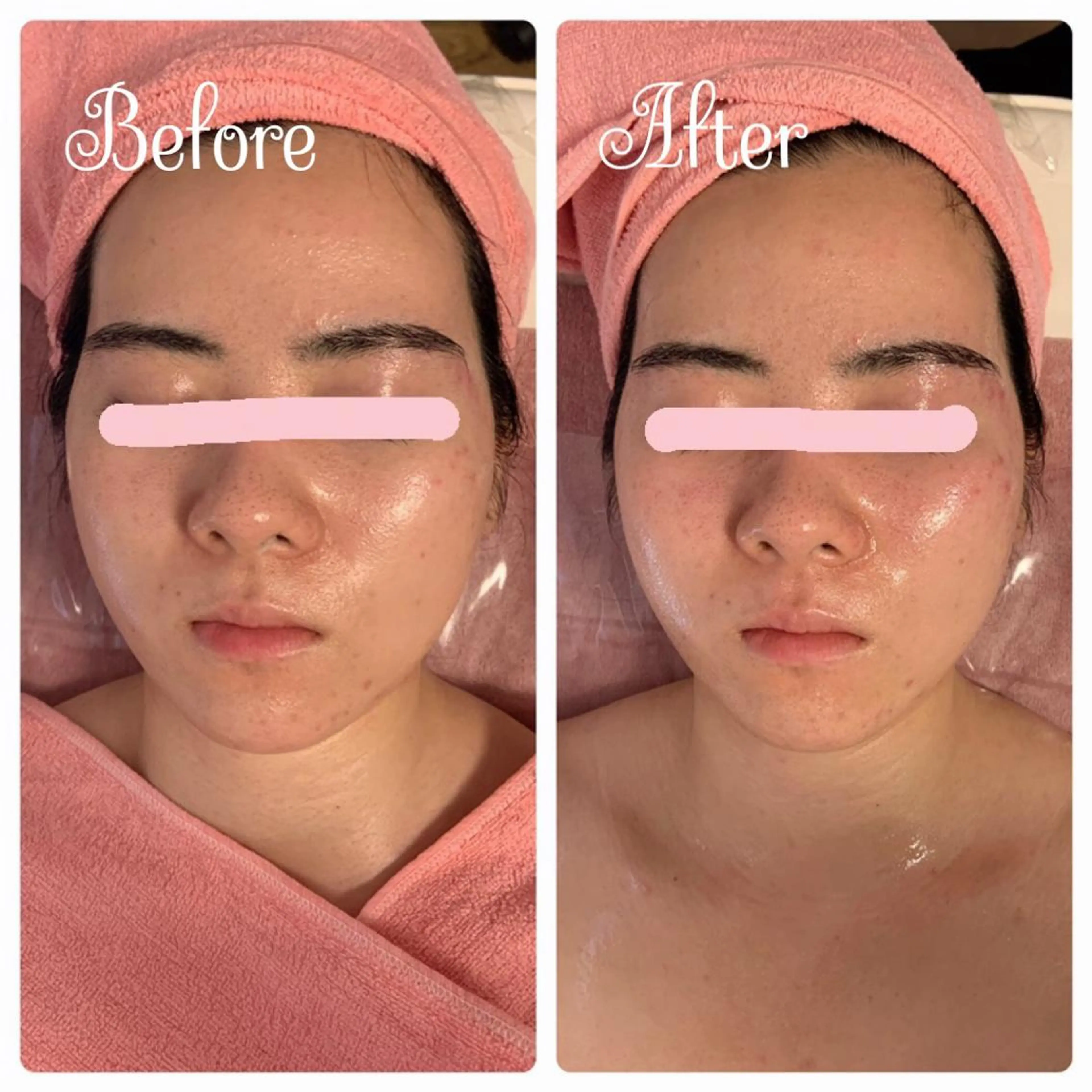 エステ リラク Linomalie エステ/たるみ/脱毛のエステ・リラクイメージ