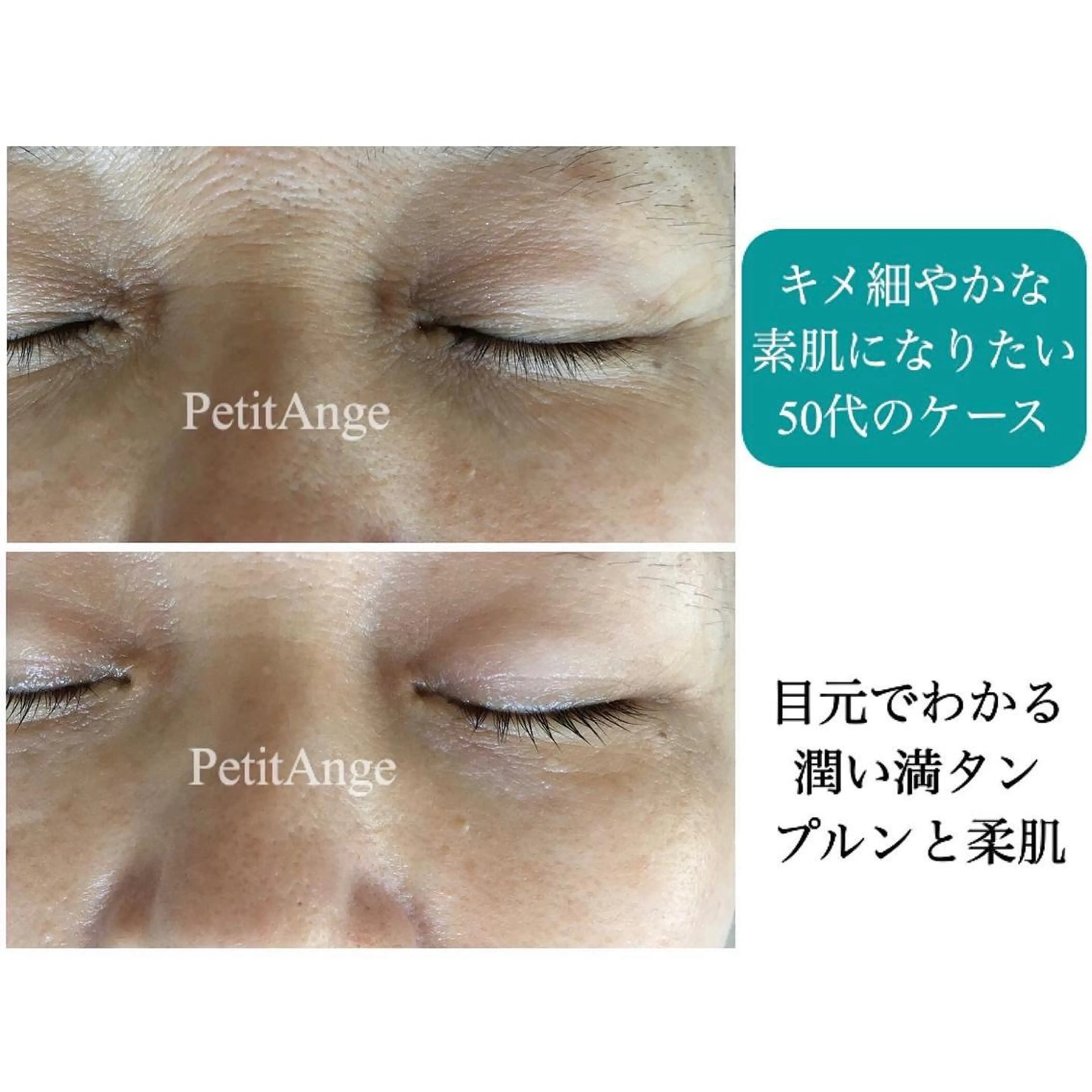 艶肌&小顔リフト❤︎ プチアンジェ茅ヶ崎のエステ・リラクイメージ