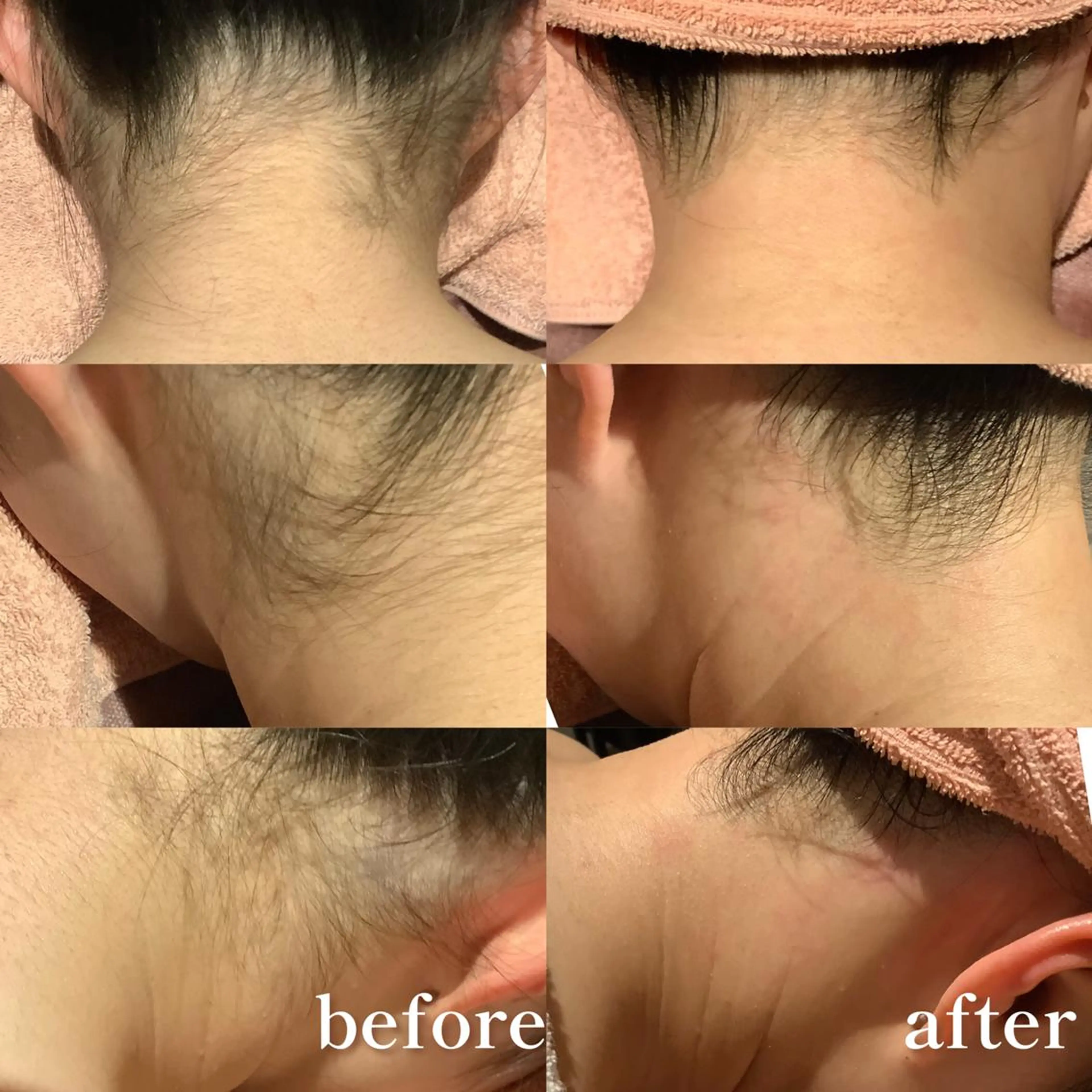 JIGGLY★ ミニモ限定クーポンのエステ・リラクイメージ