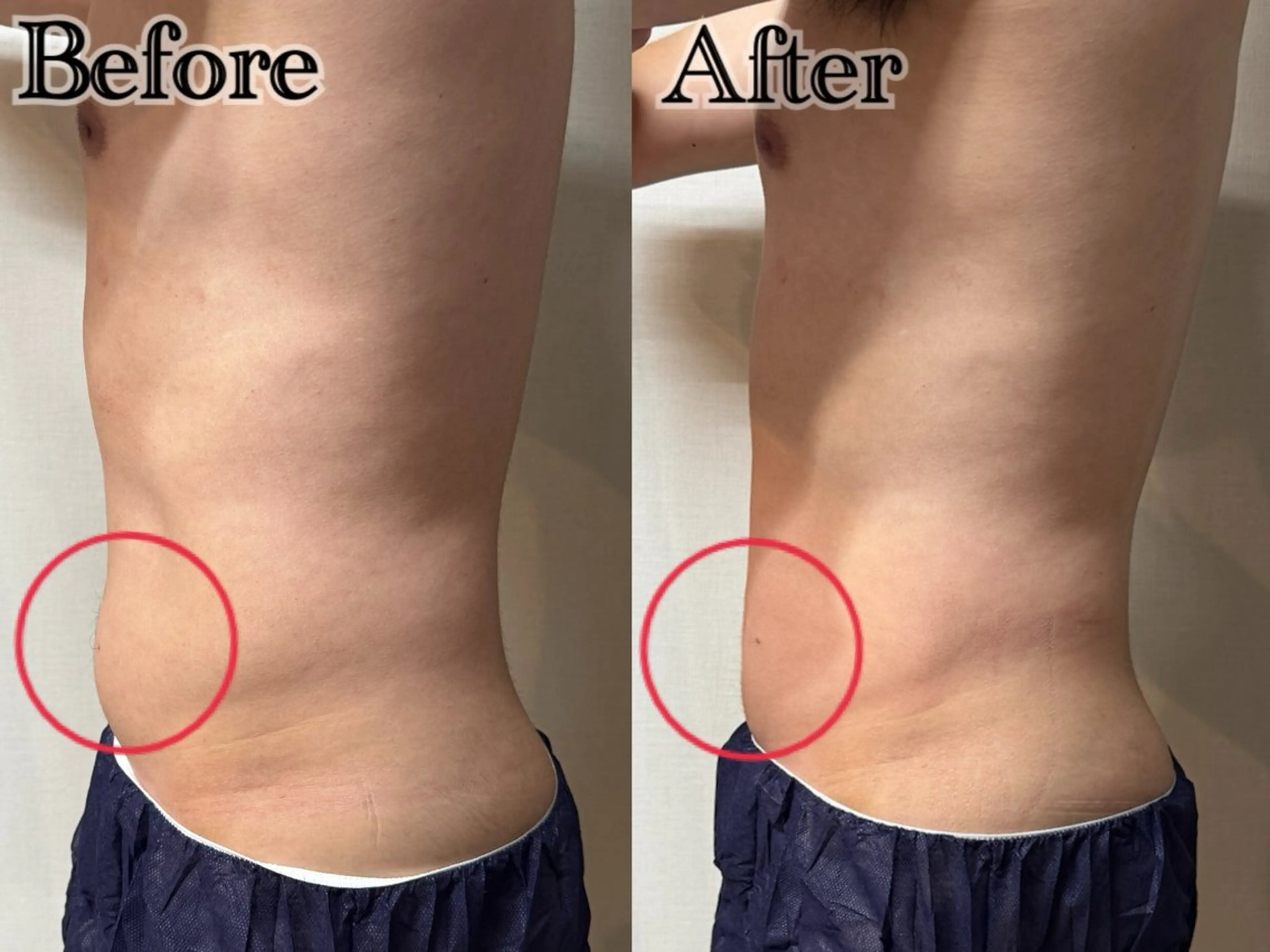 エステ 六本木脱毛andS 店長Sachiのエステ・リラクイメージ