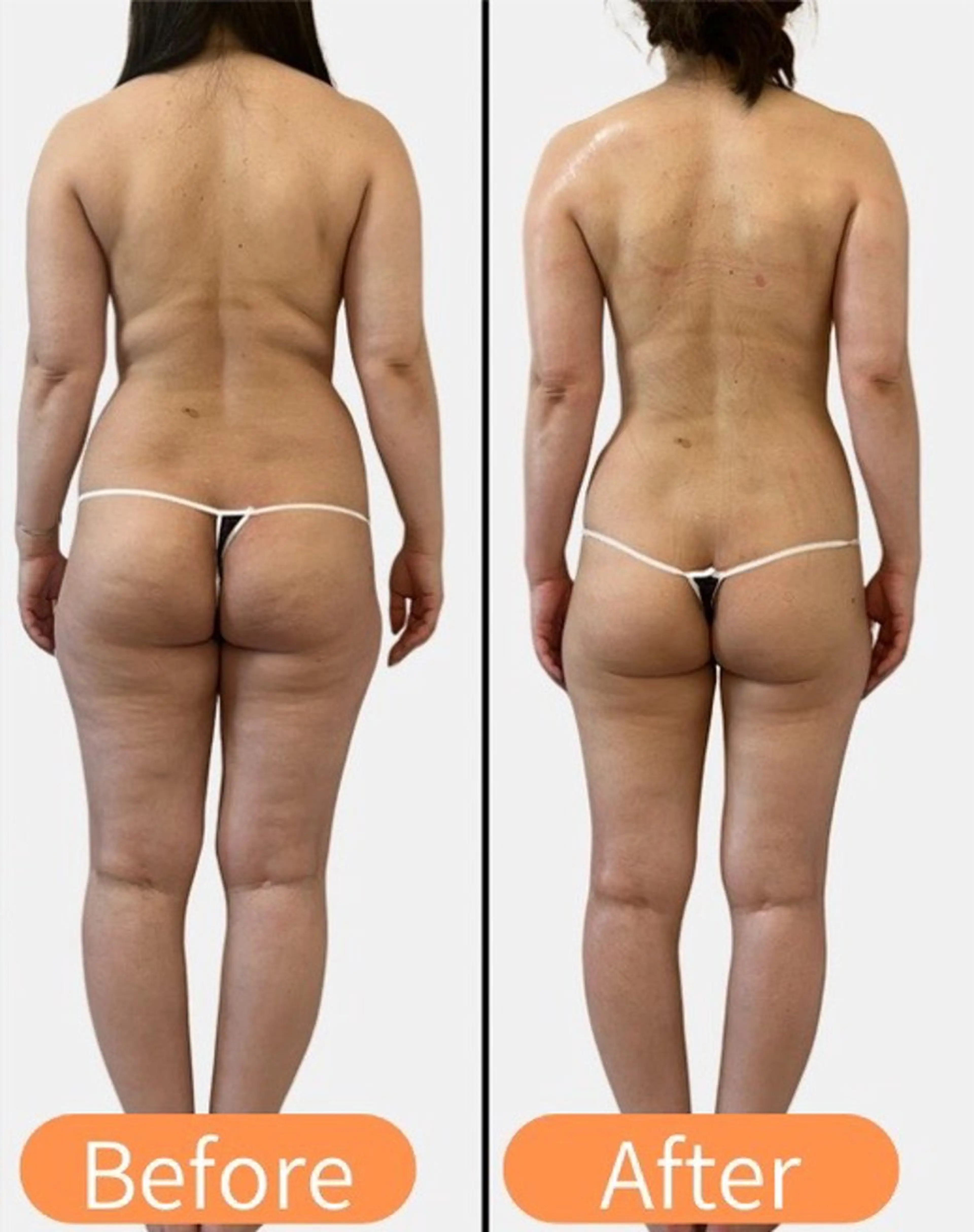 【メリハリ美ボディに◉】キャビテーション&ラジオ波&EMS &発汗デトックス90分の写真