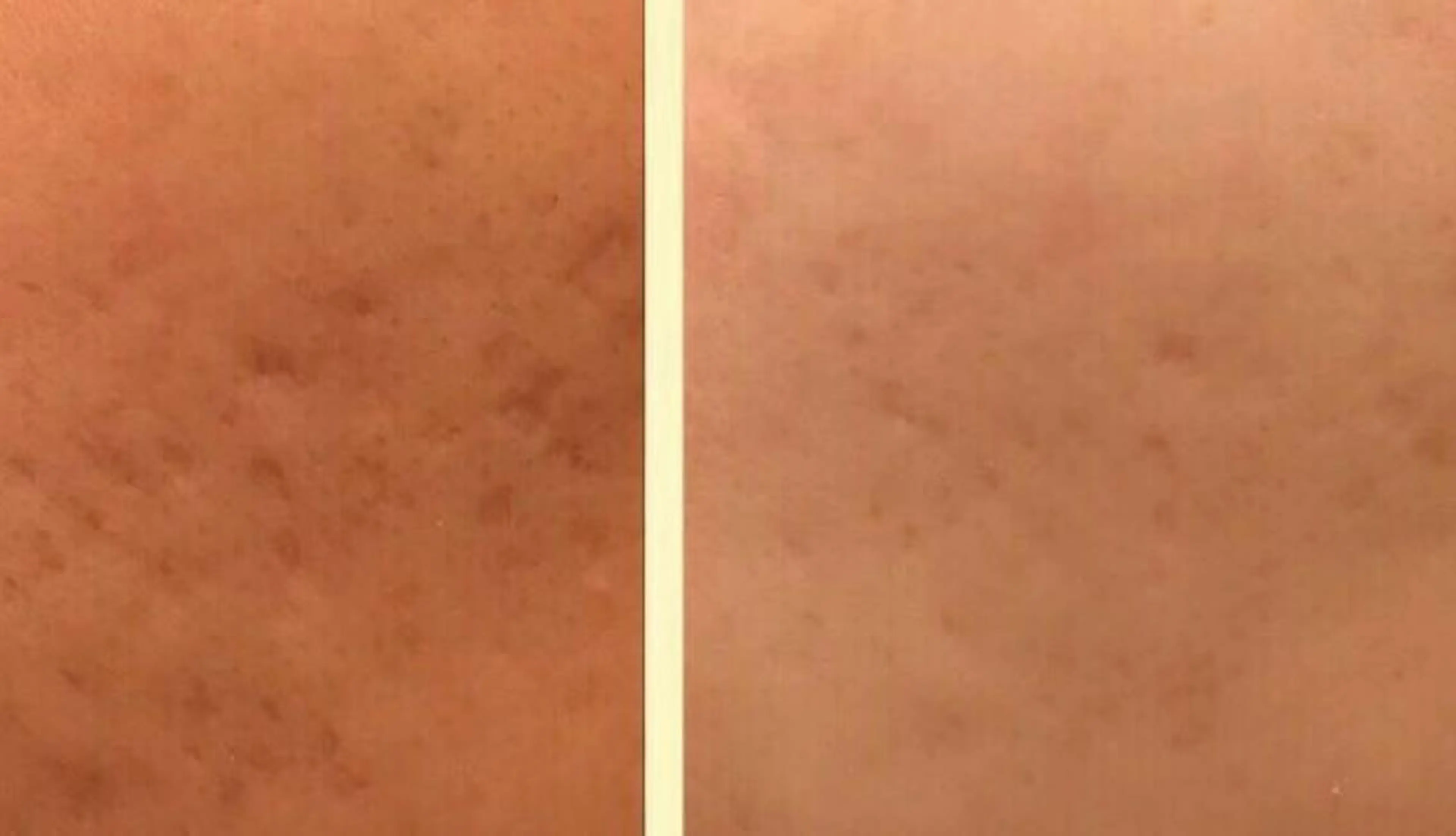 朝重い人専用 肩甲骨調整のエステ・リラクイメージ