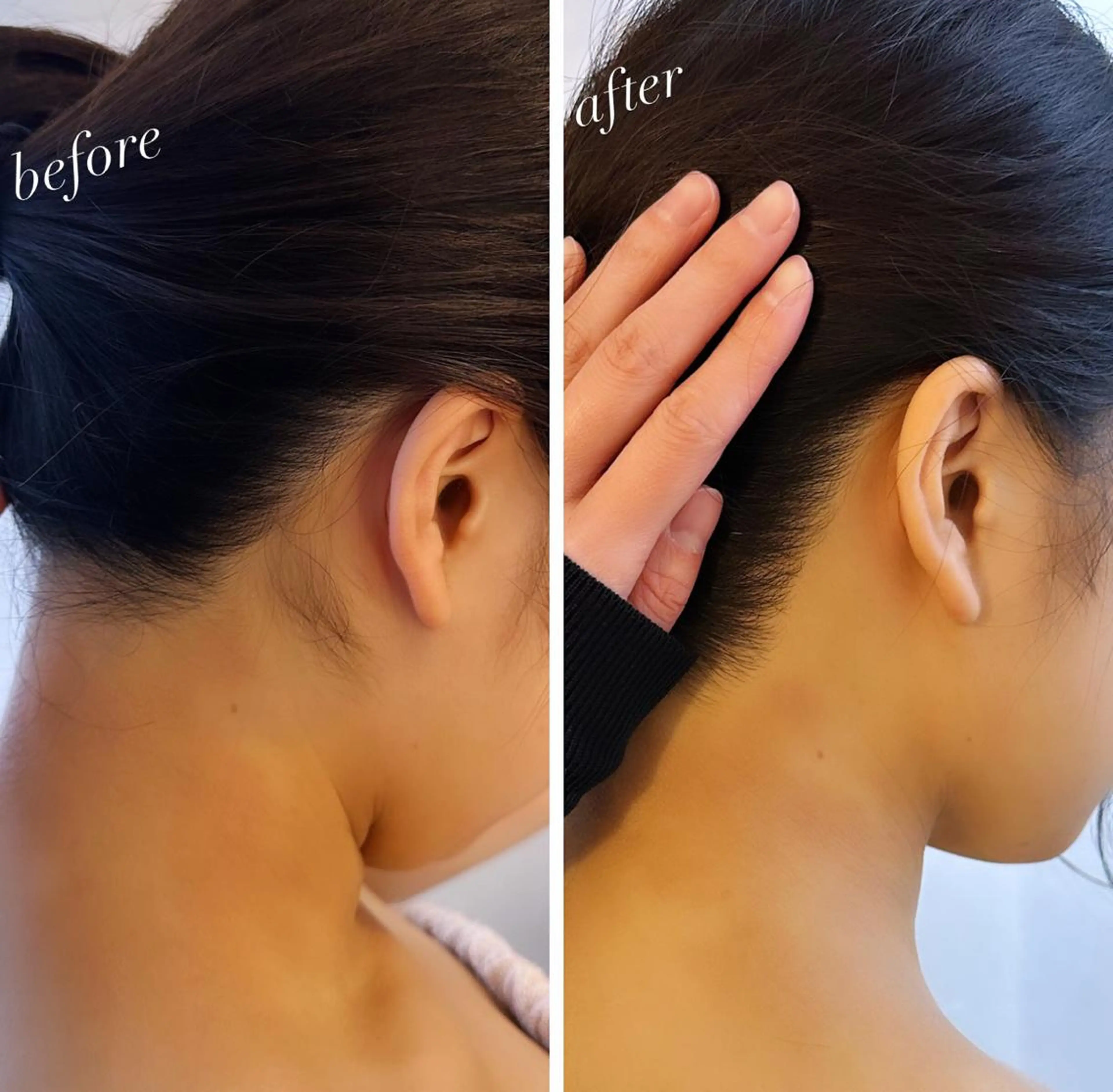 うなじ脱毛/美肌脱毛 LABELのエステ・リラクイメージ