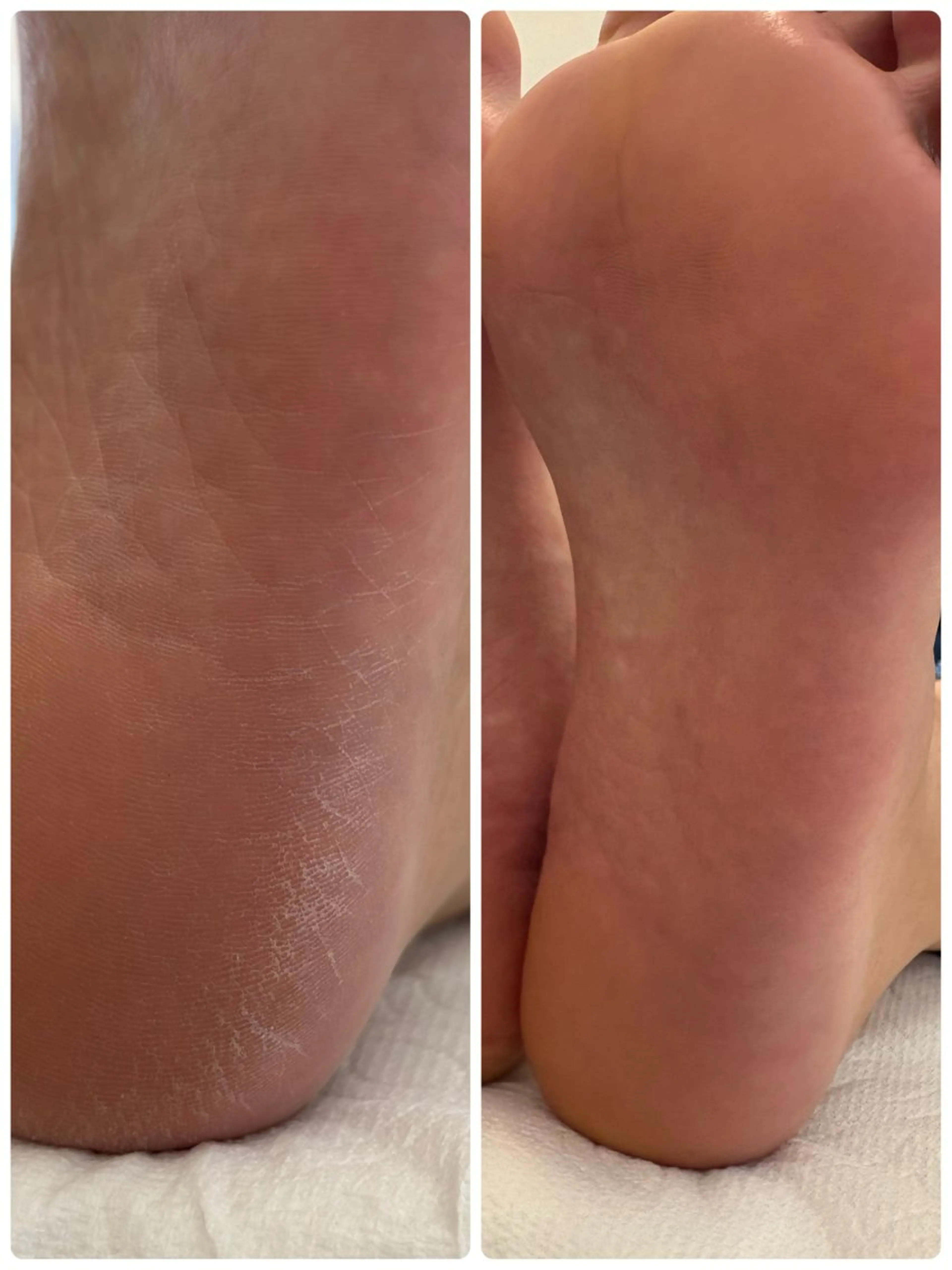 ネイル その他(ネイル) non nail ⭐︎のネイルデザイン