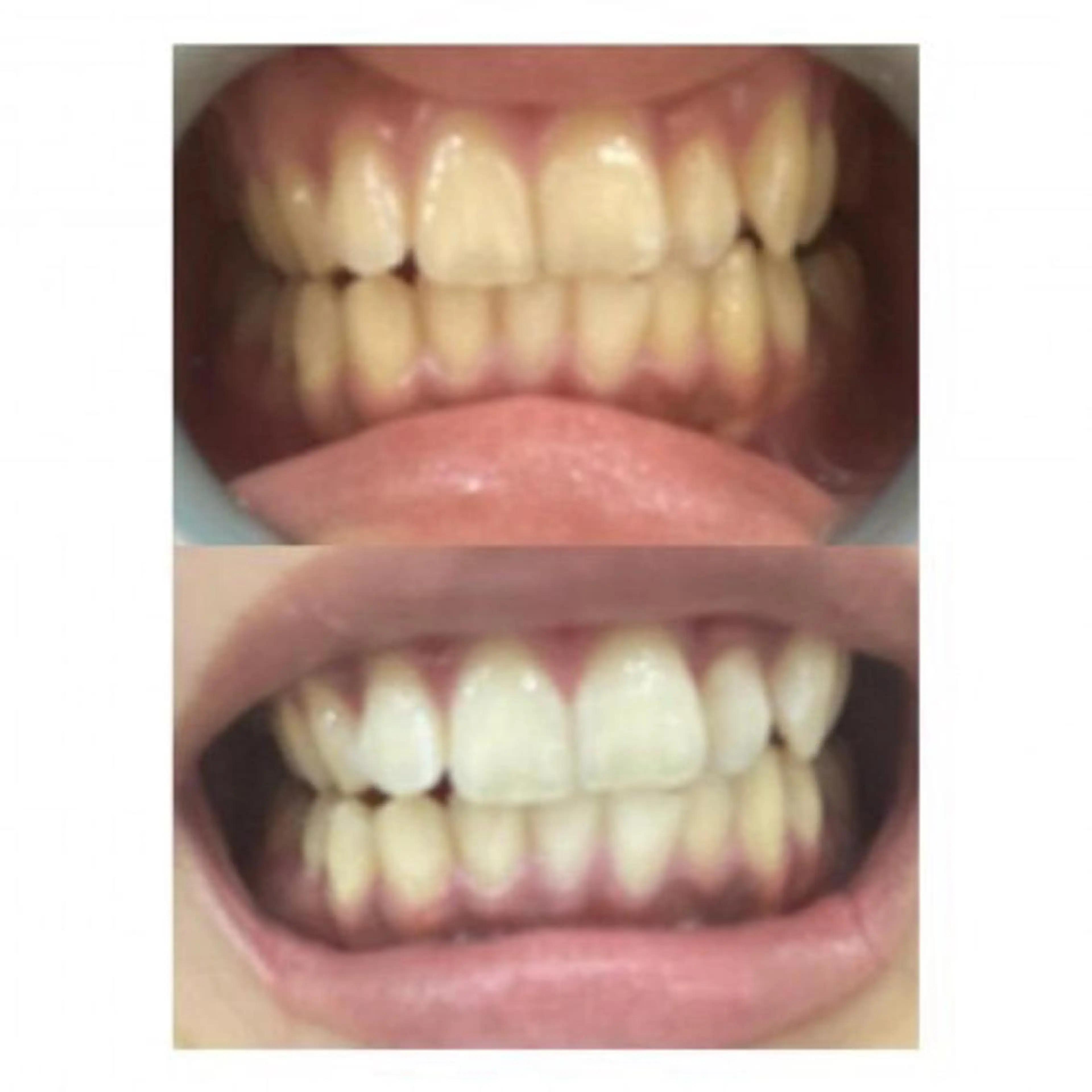 M渋谷 ホワイトニングのエステ・リラクイメージ