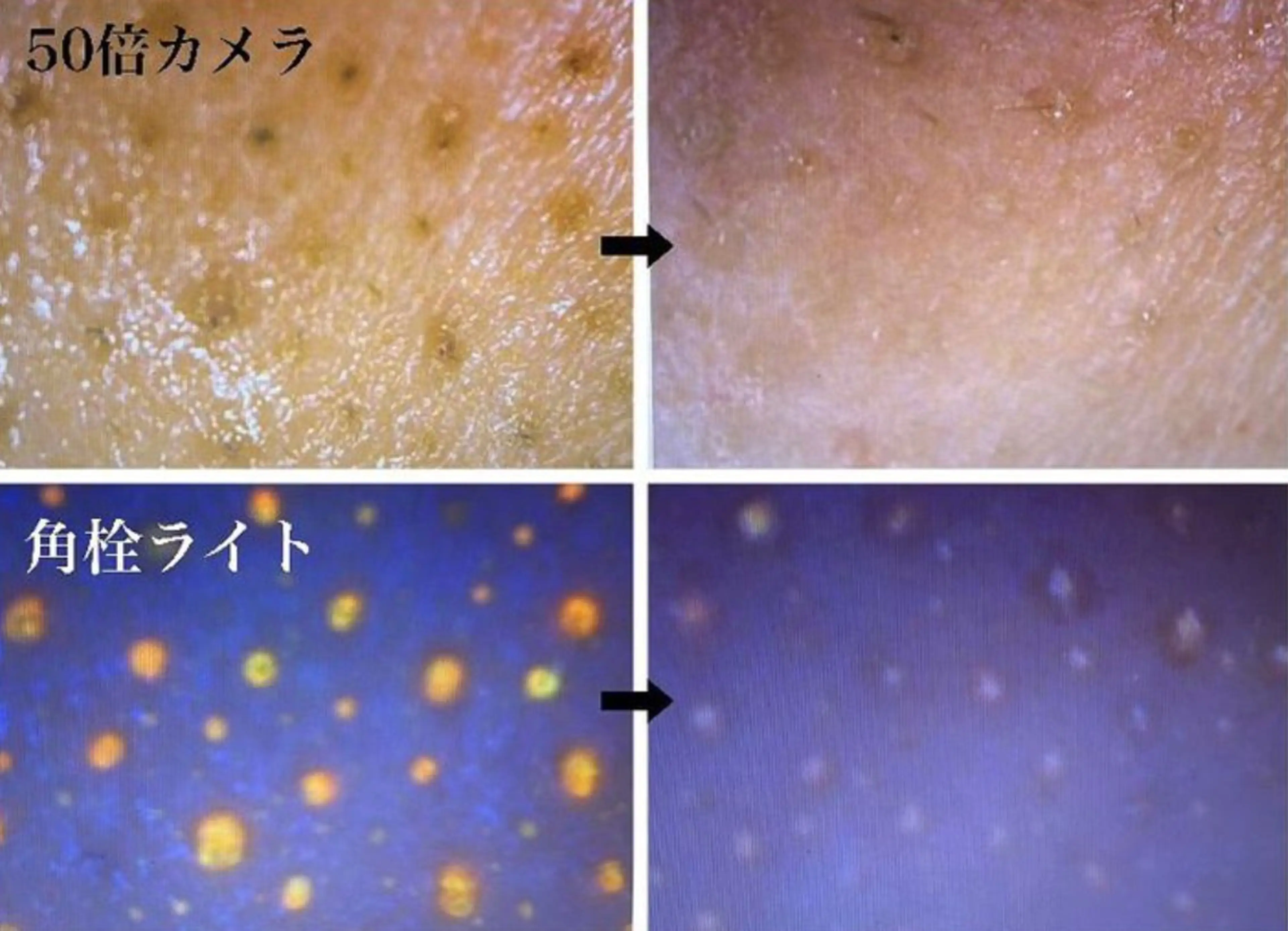 ポアレスサロン フィルのエステ・リラクイメージ