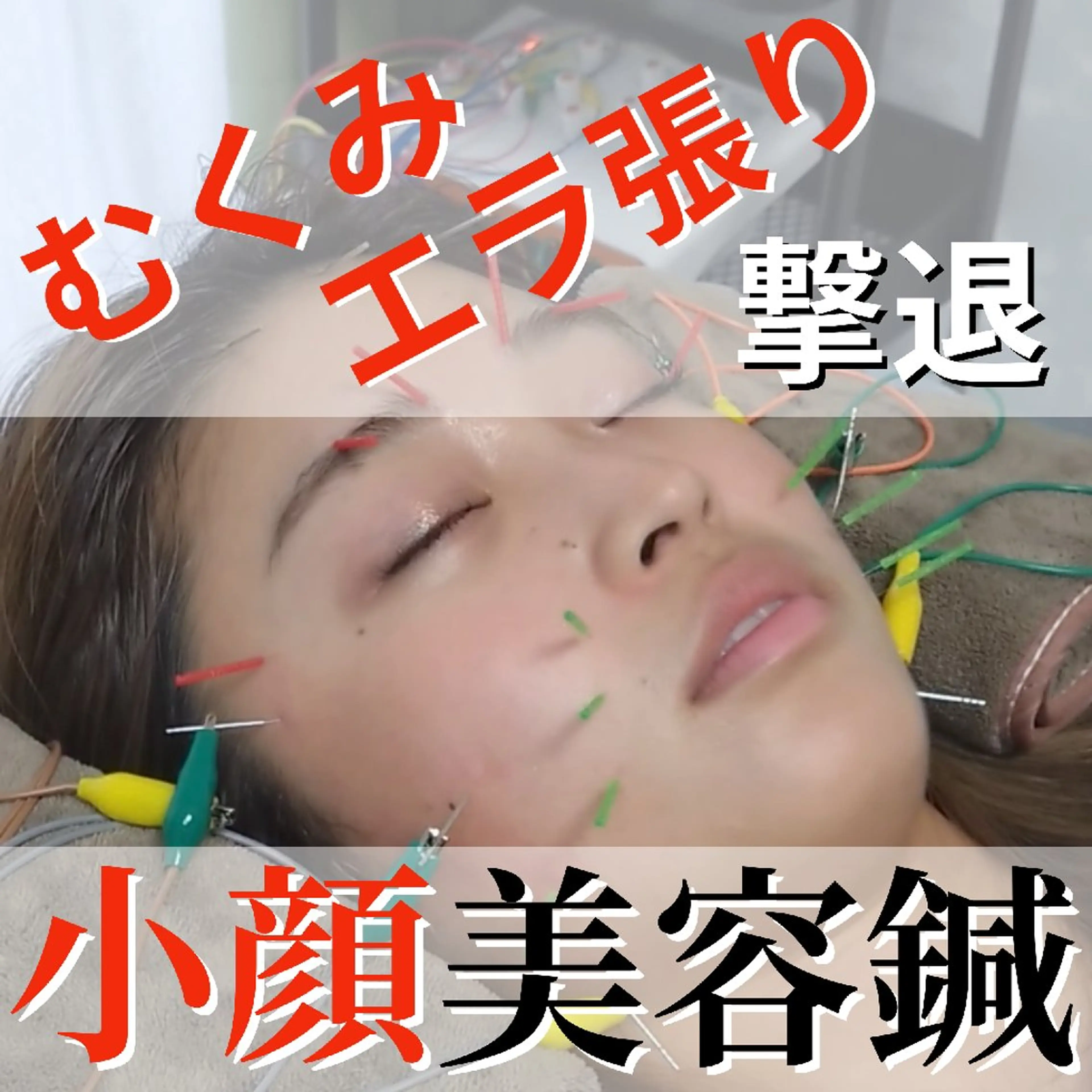 たるみ専門美容鍼 × 猫背整体 のぐち所属・小顔と姿勢改善のプロ ｜整体と美容鍼のぐちのエステ・リラクイメージ