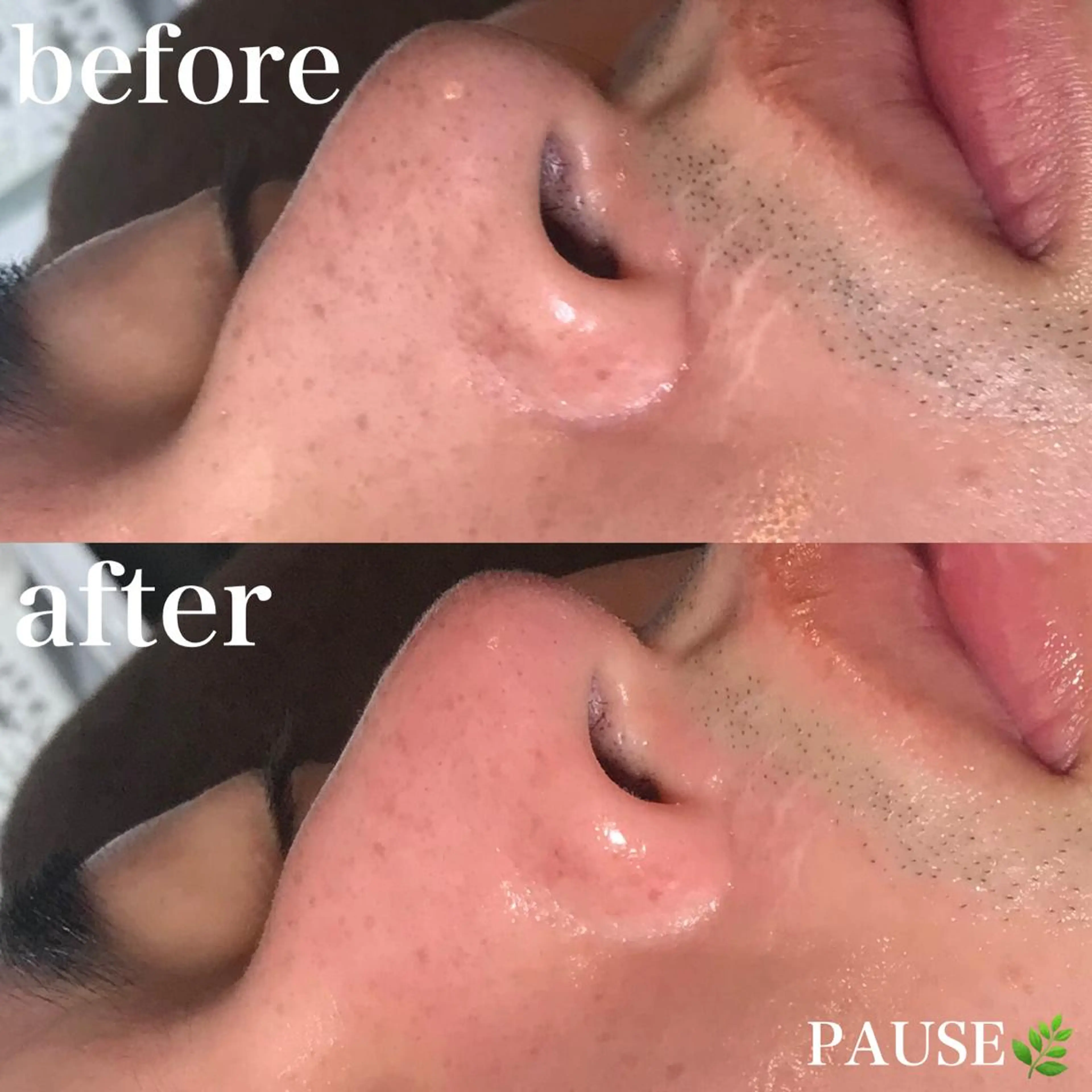 エステ 浜野 恵美のエステ・リラクイメージ