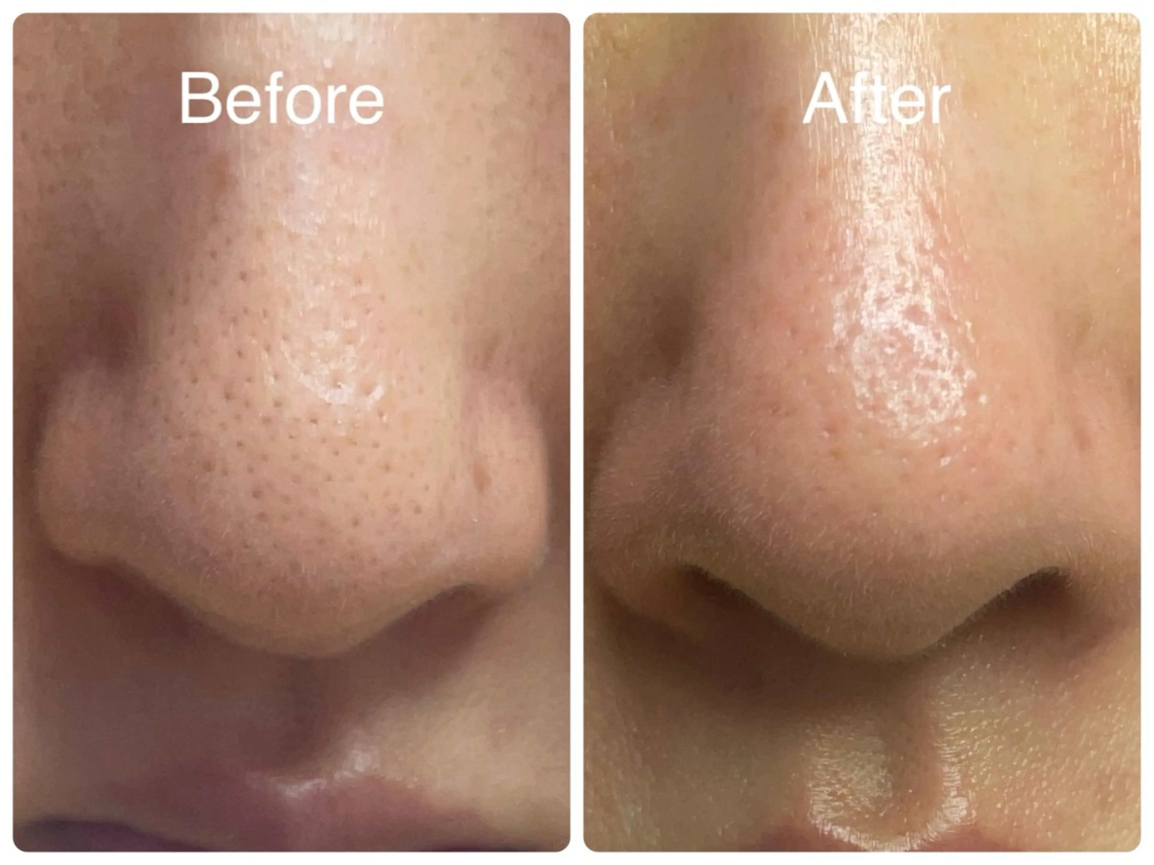 エステ salon HATOのエステ・リラクイメージ