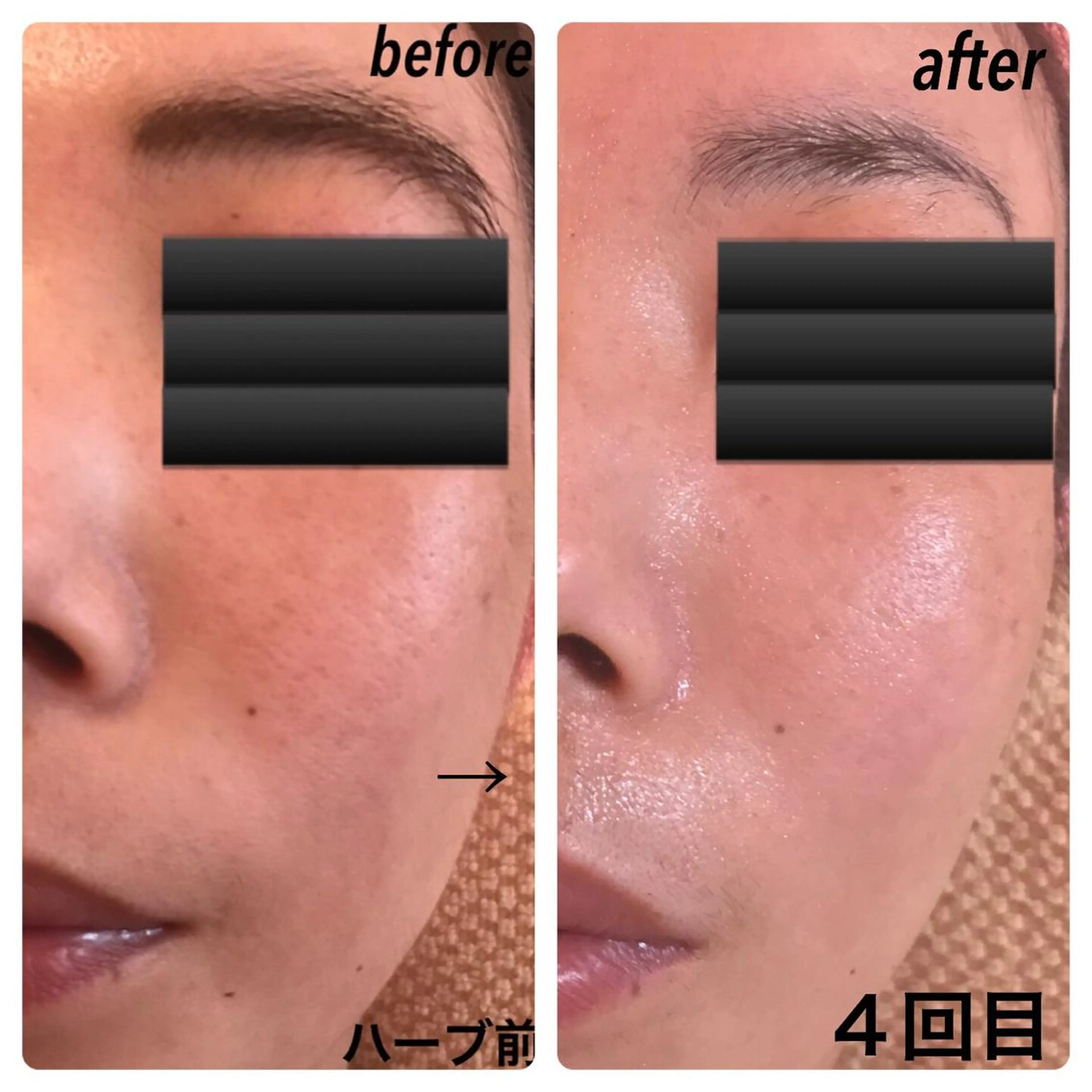 フェアリーローズ所属・fairyrose organicエステのエステ・リラクイメージ