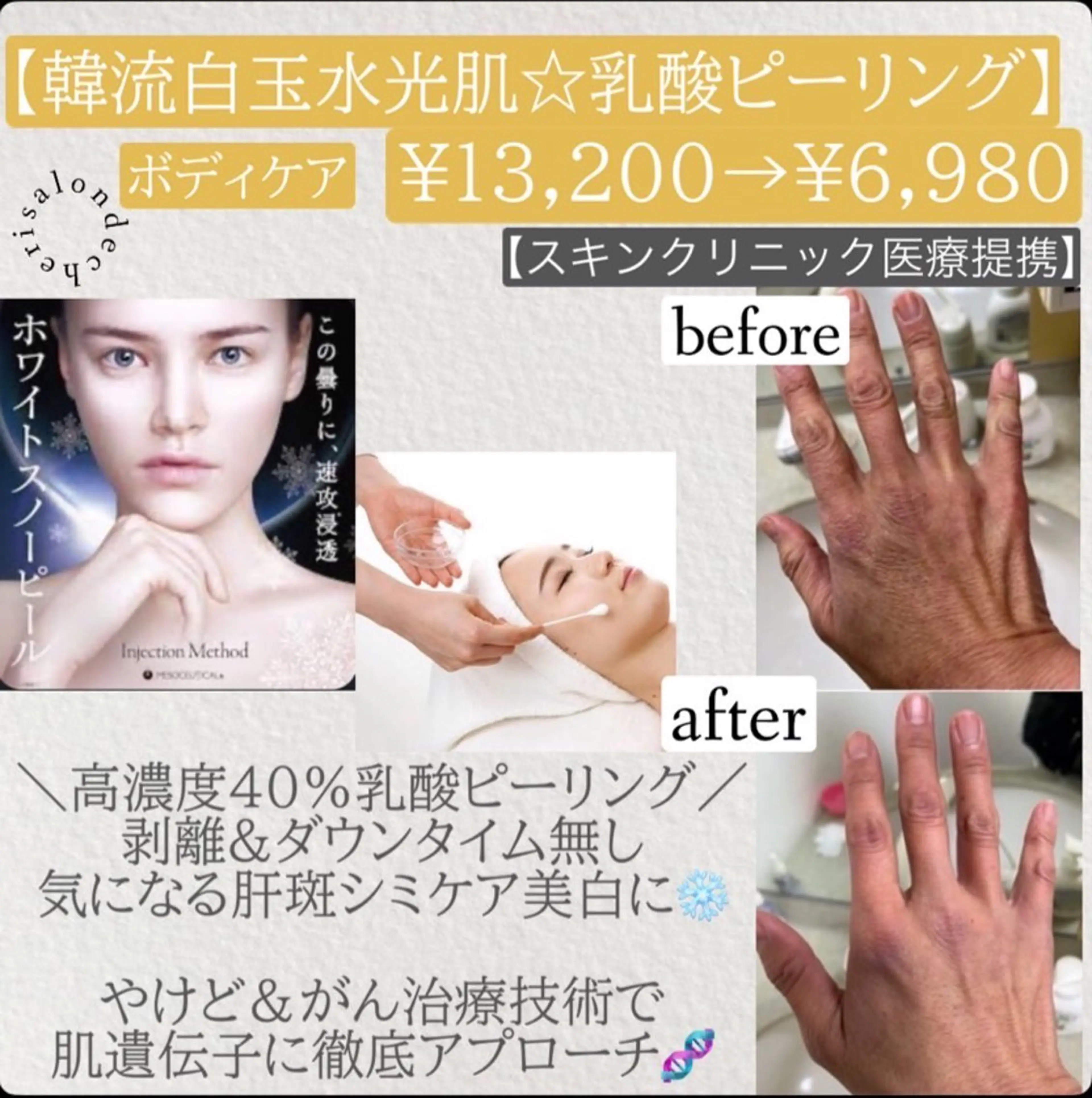 Salon de cheri サロンドシェリ人形町店所属・毛穴のお悩み・シミ 松本瞳のエステ・リラクイメージ