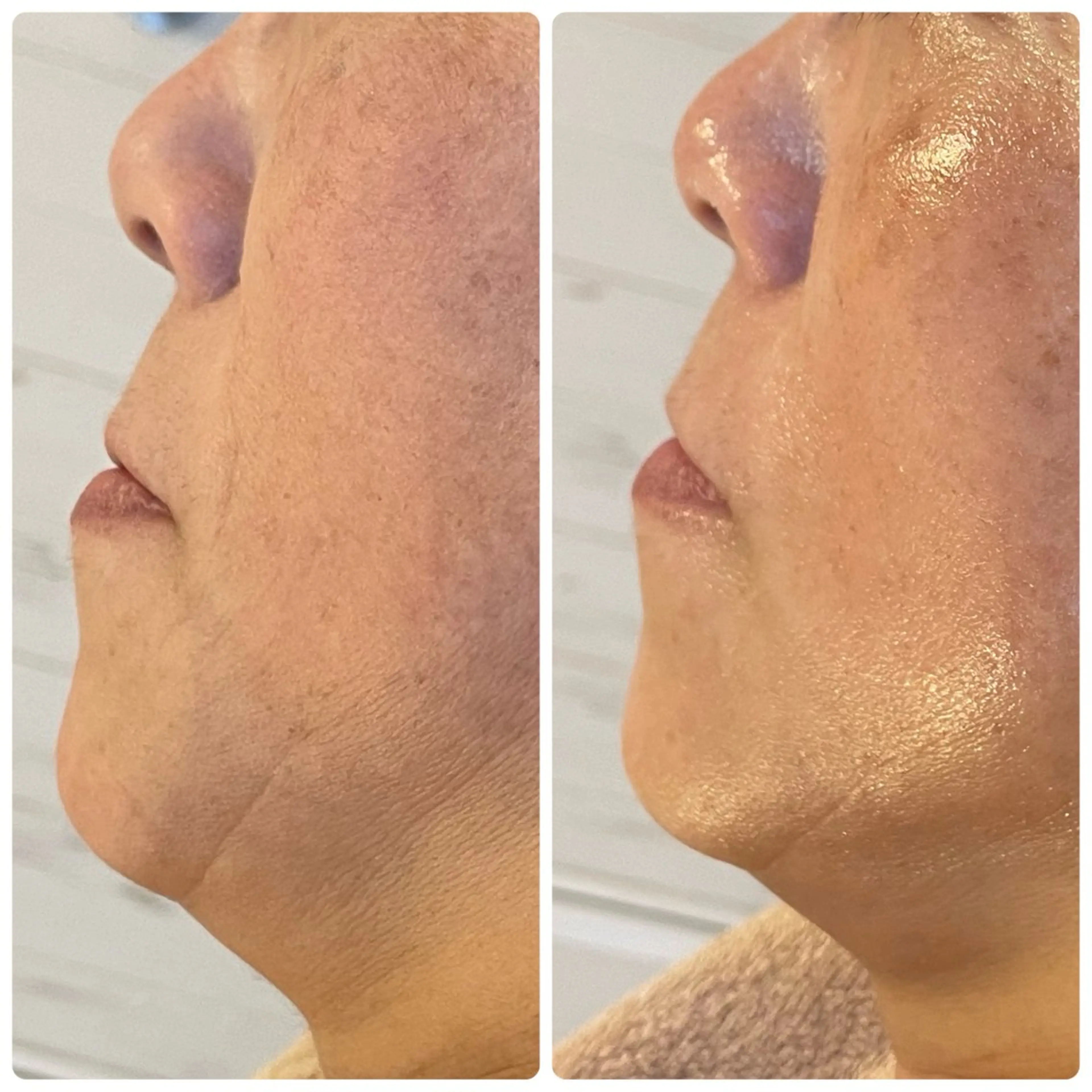 エステ リラク 小顔・たるみケア✨ フェイシャル&ボディのエステ・リラクイメージ