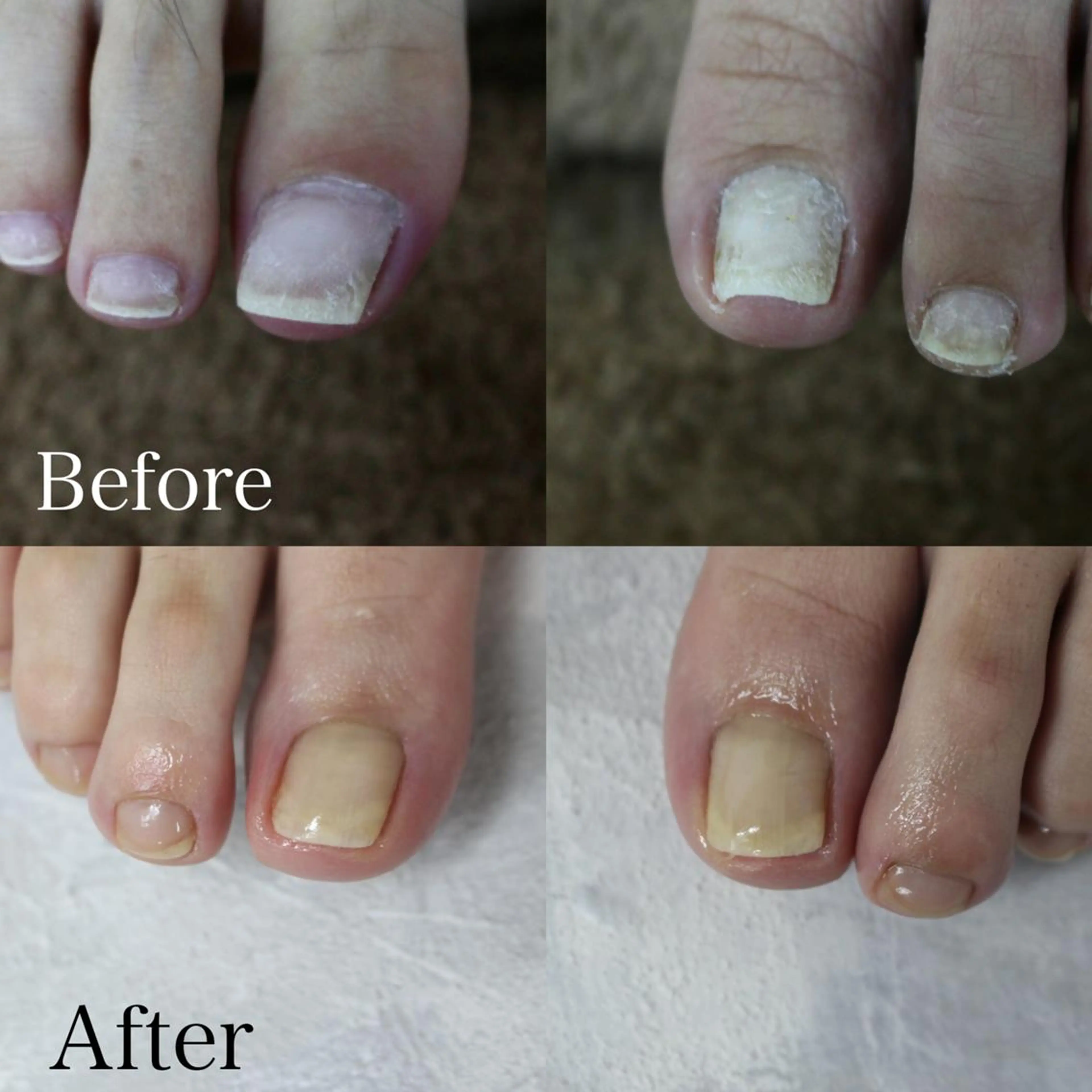 東 あきらのネイルデザイン