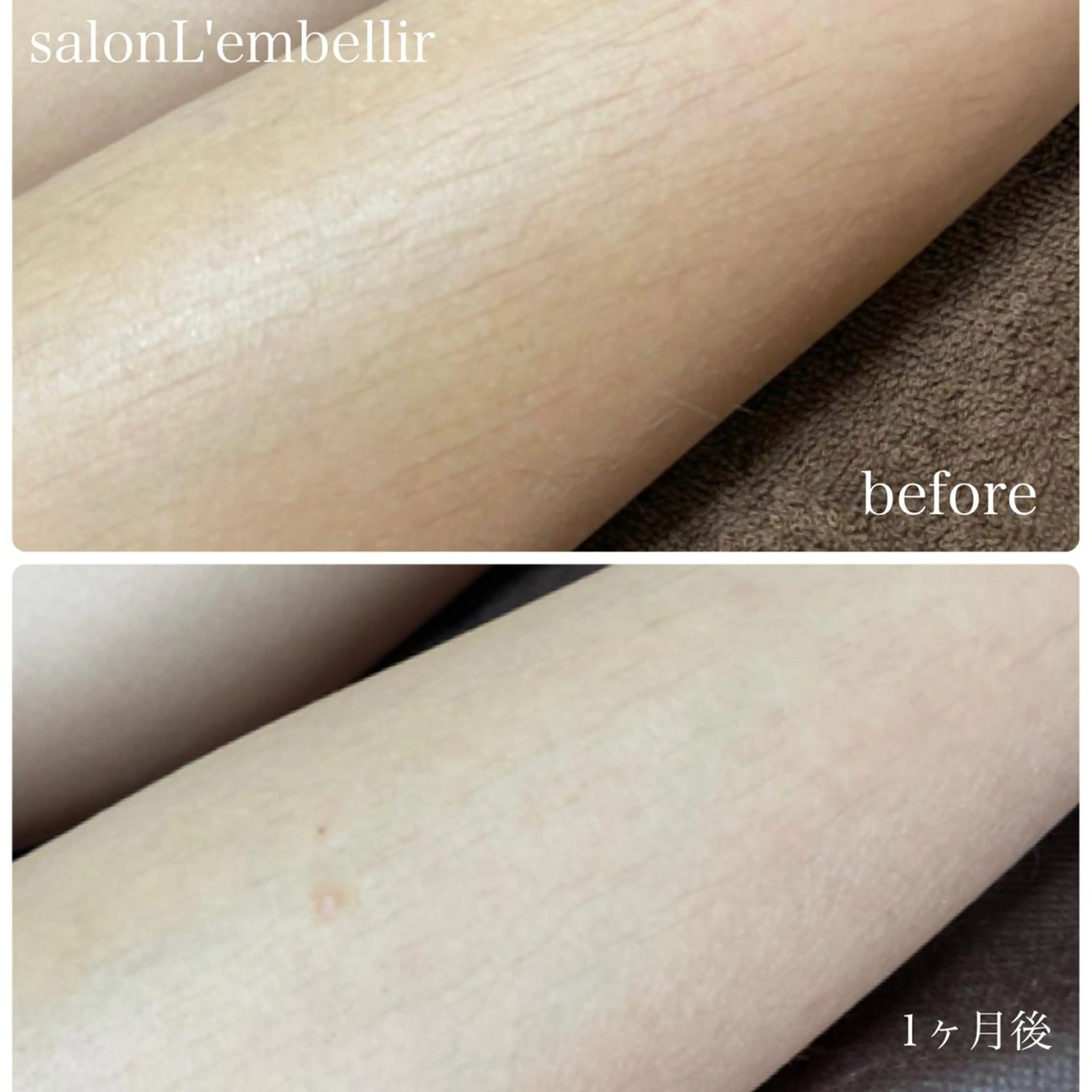 脱毛 salon L'embellirのネイルデザイン