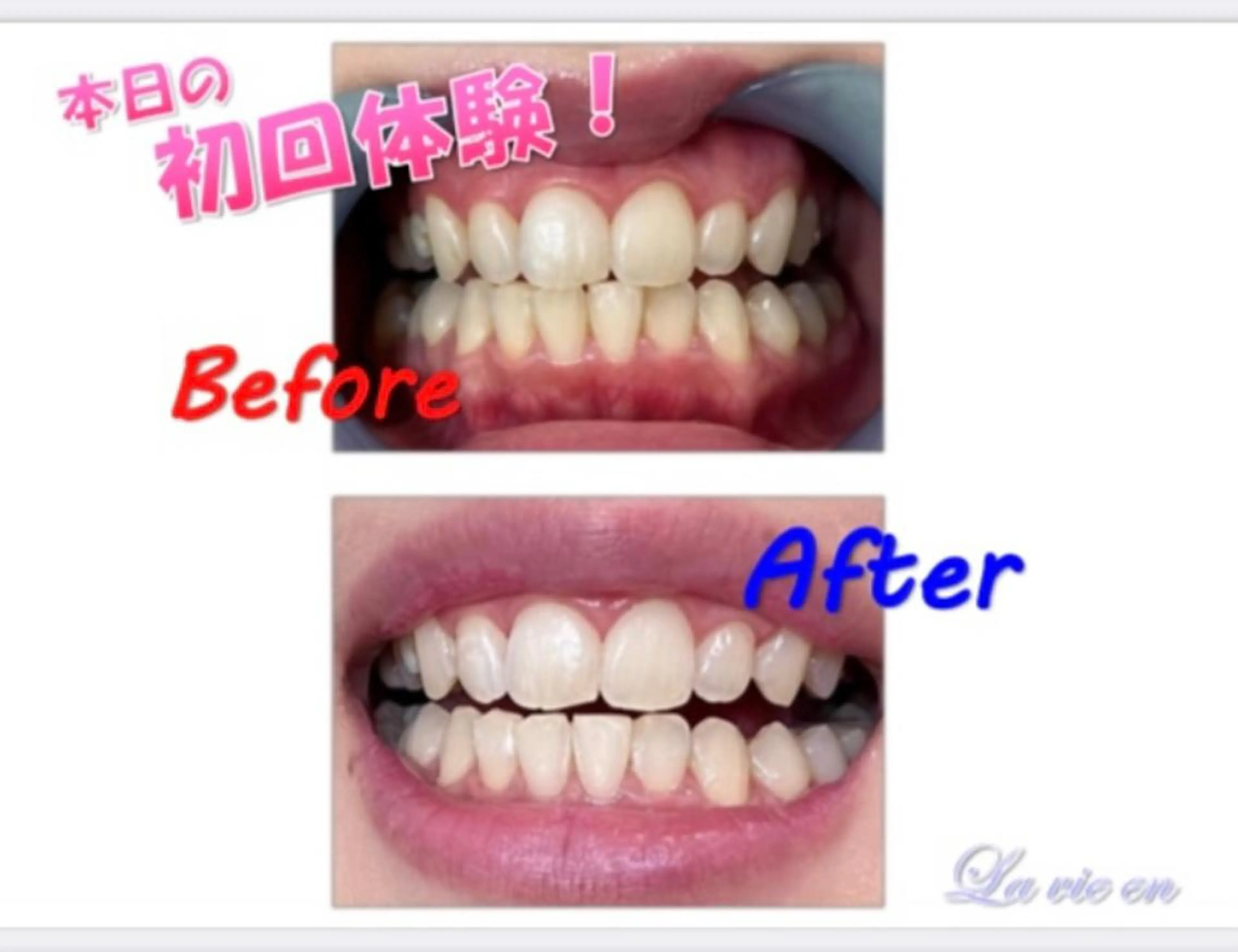 その他 ホワイトニングサロン La vie enのその他イメージ